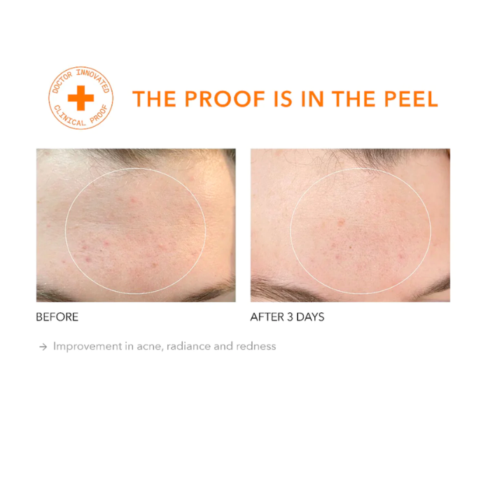 Alpha Beta® Extra Strength Daily Peel Pack