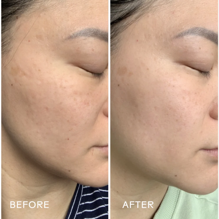 Suero de ácido hialurónico con hongos y ciruela kakadu Dew Drops™