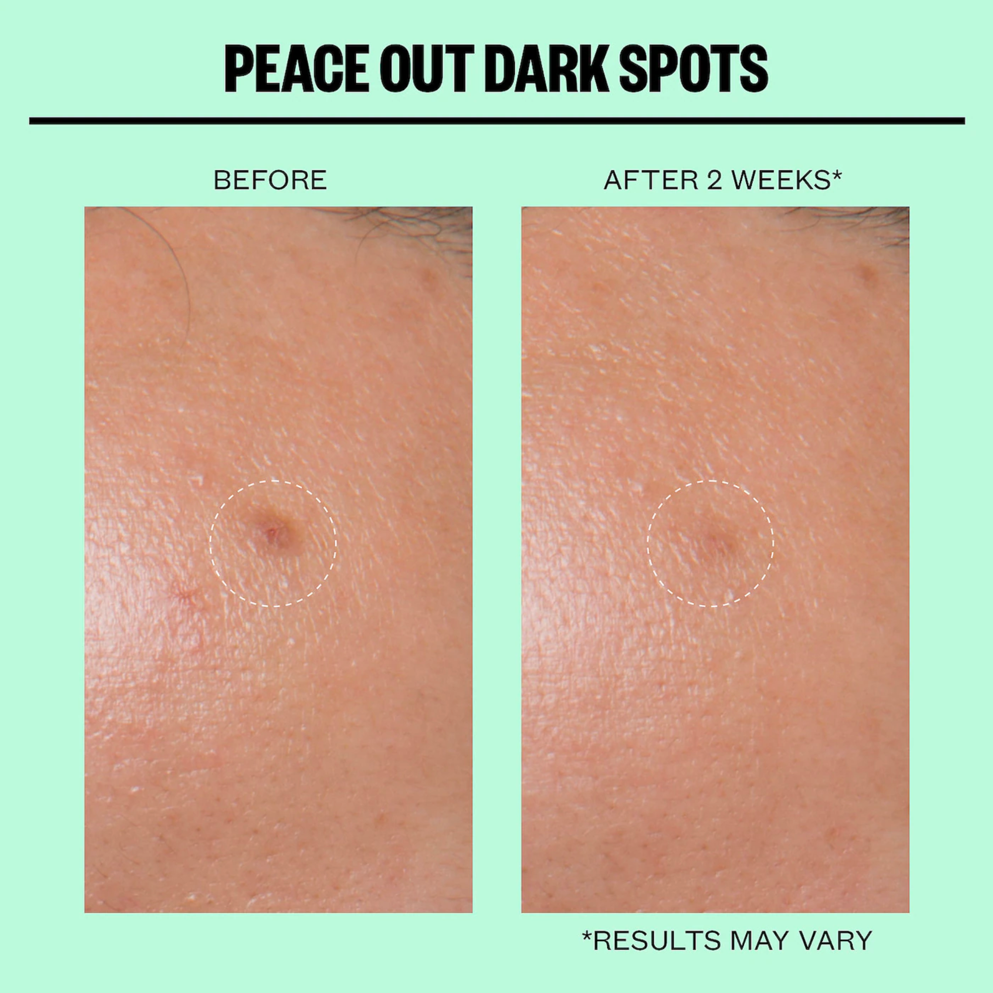 Microneedling Dark Spot Brightening Dots