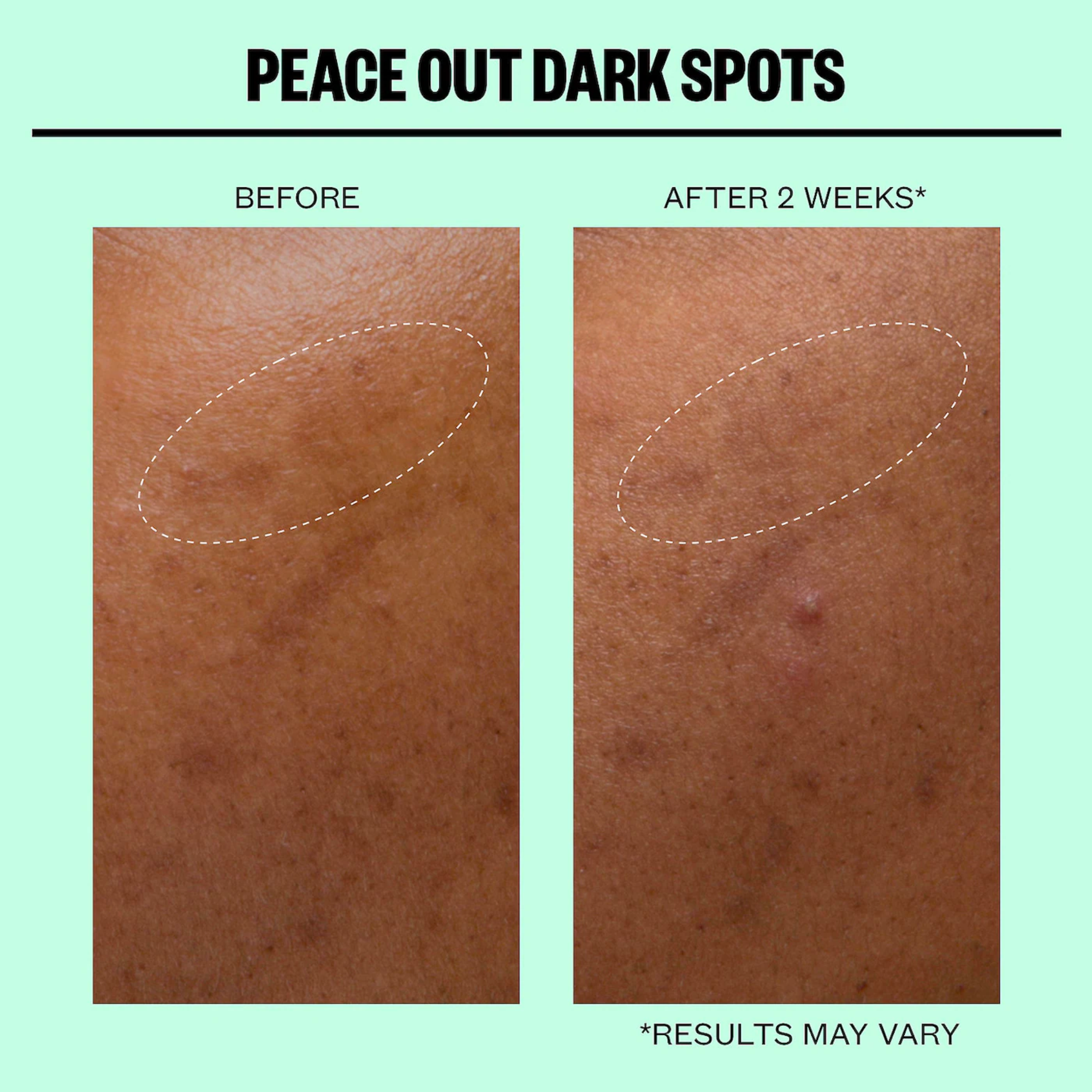 Microneedling Dark Spot Brightening Dots