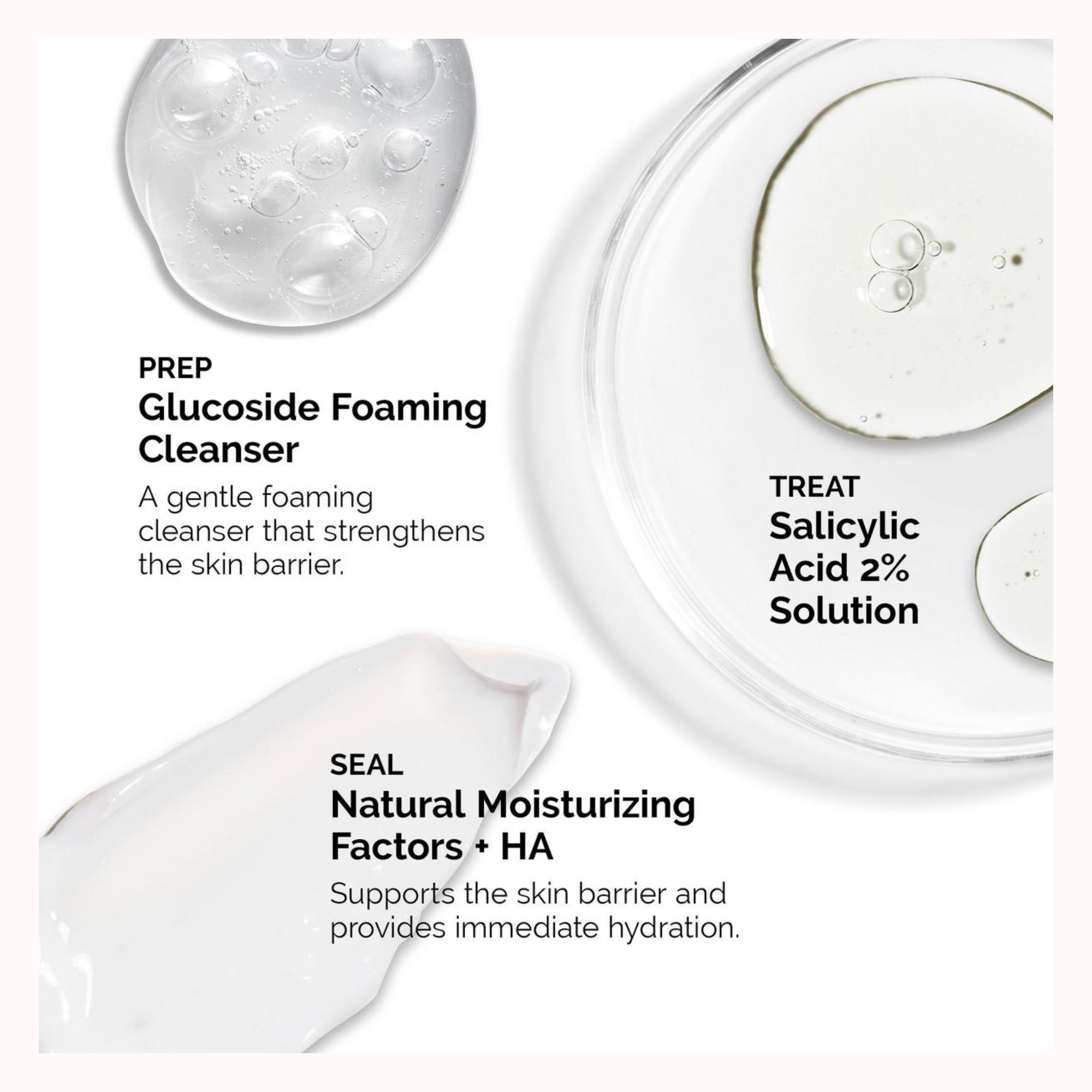 The Acne Set: 3-Step Regimen Kit