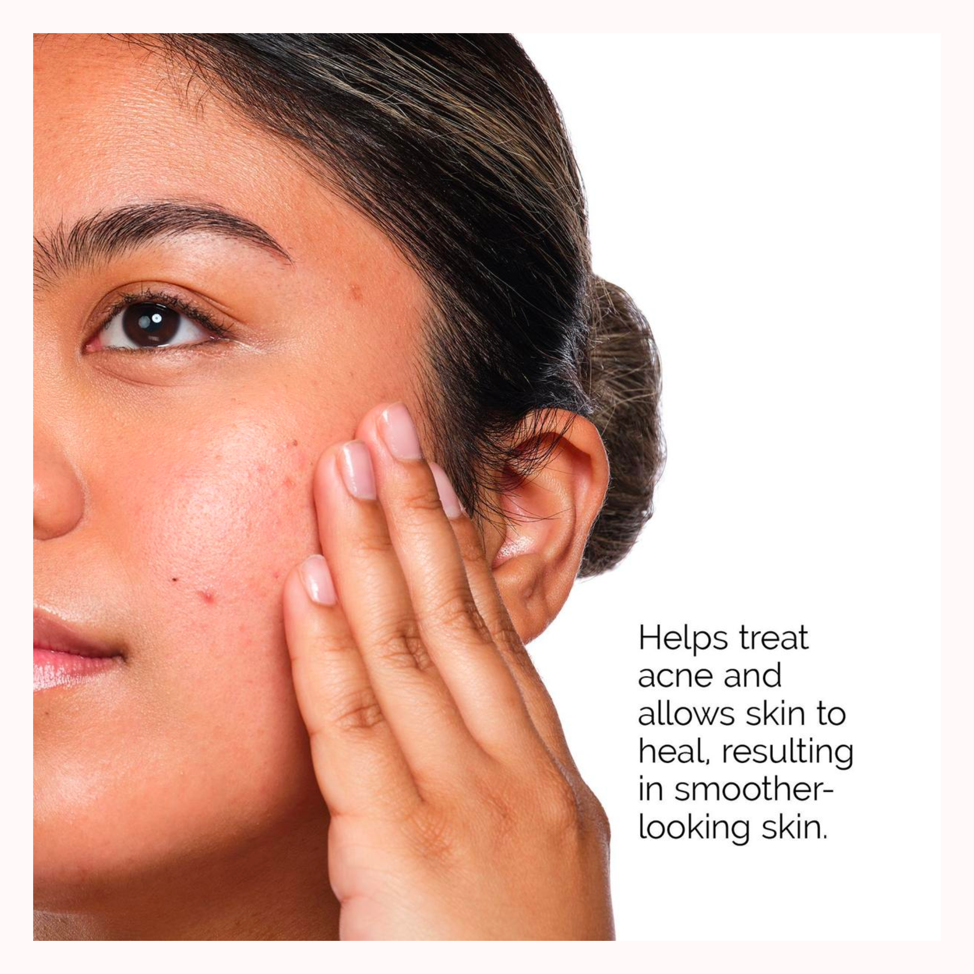 The Acne Set: 3-Step Regimen Kit