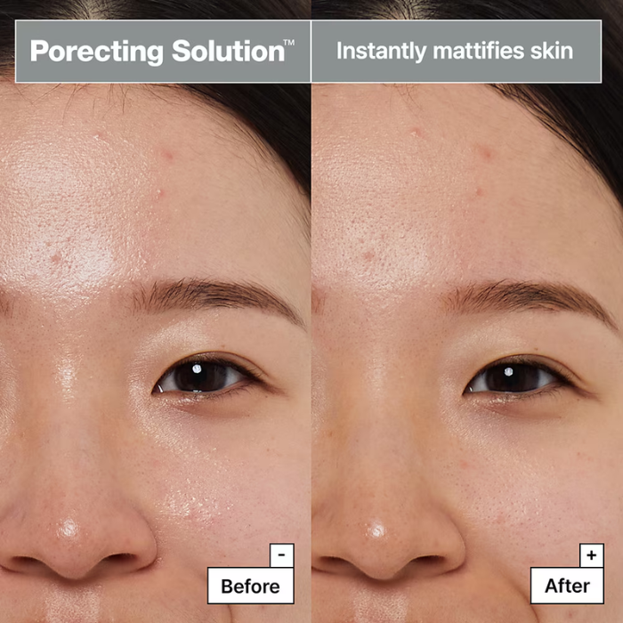 Dermask™ Porecting Solution Face Mask