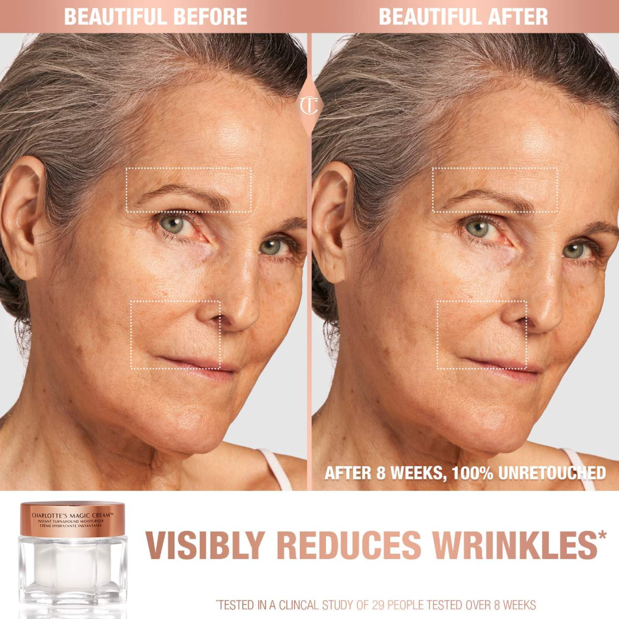 Magic Cream Anti-aging Moisturizer With Hyaluronic Acid