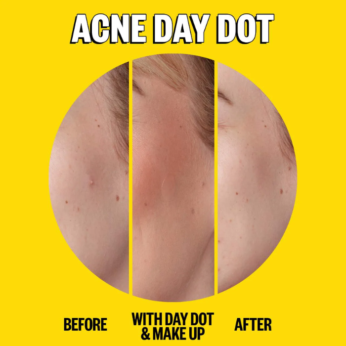 Acne Salicylic Acid Day & Night Duo