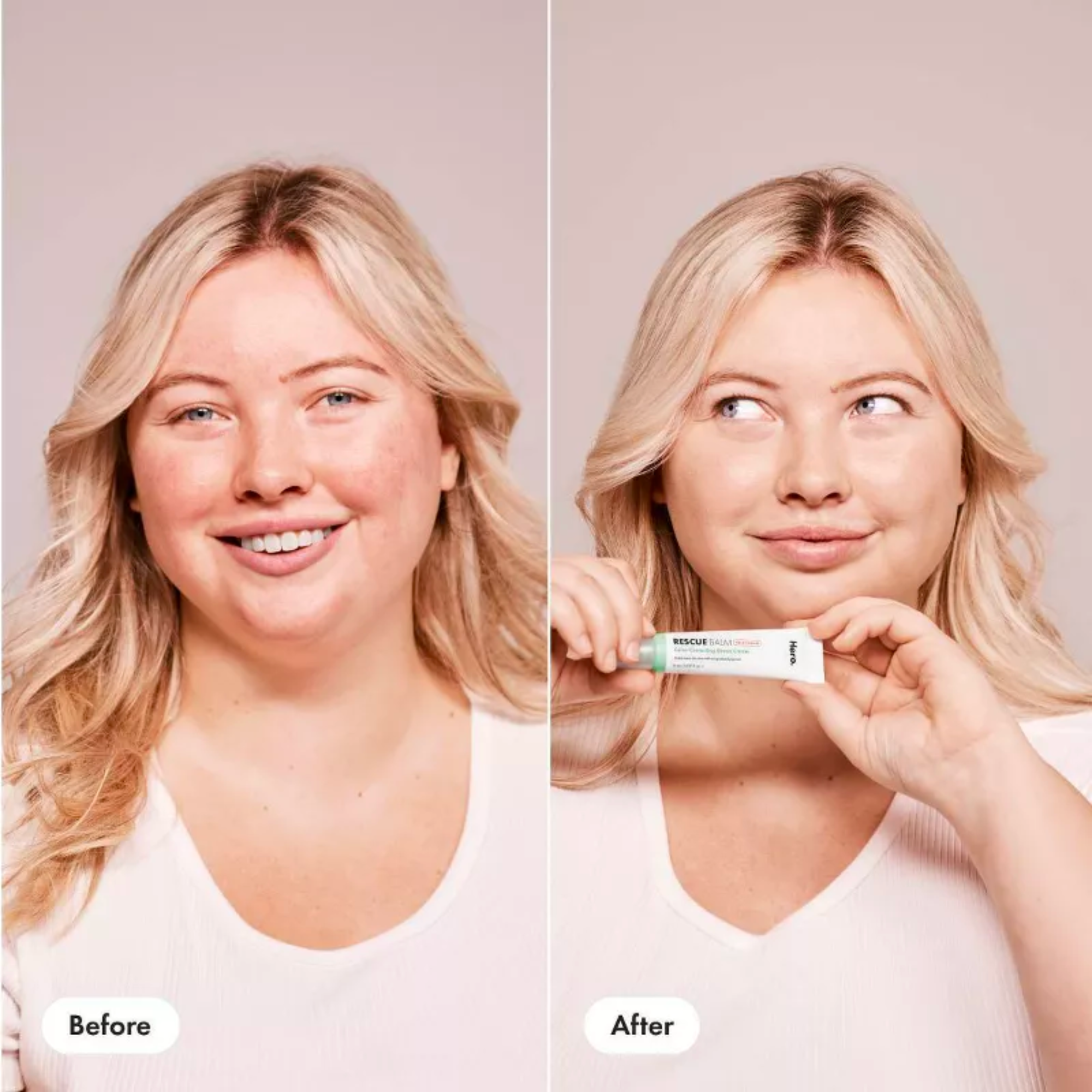 Rescue Balm +Red Correct