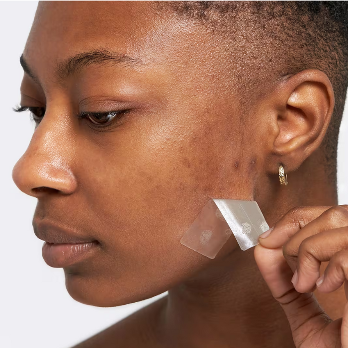 Mighty Patch Surface Acne Pimple Patches