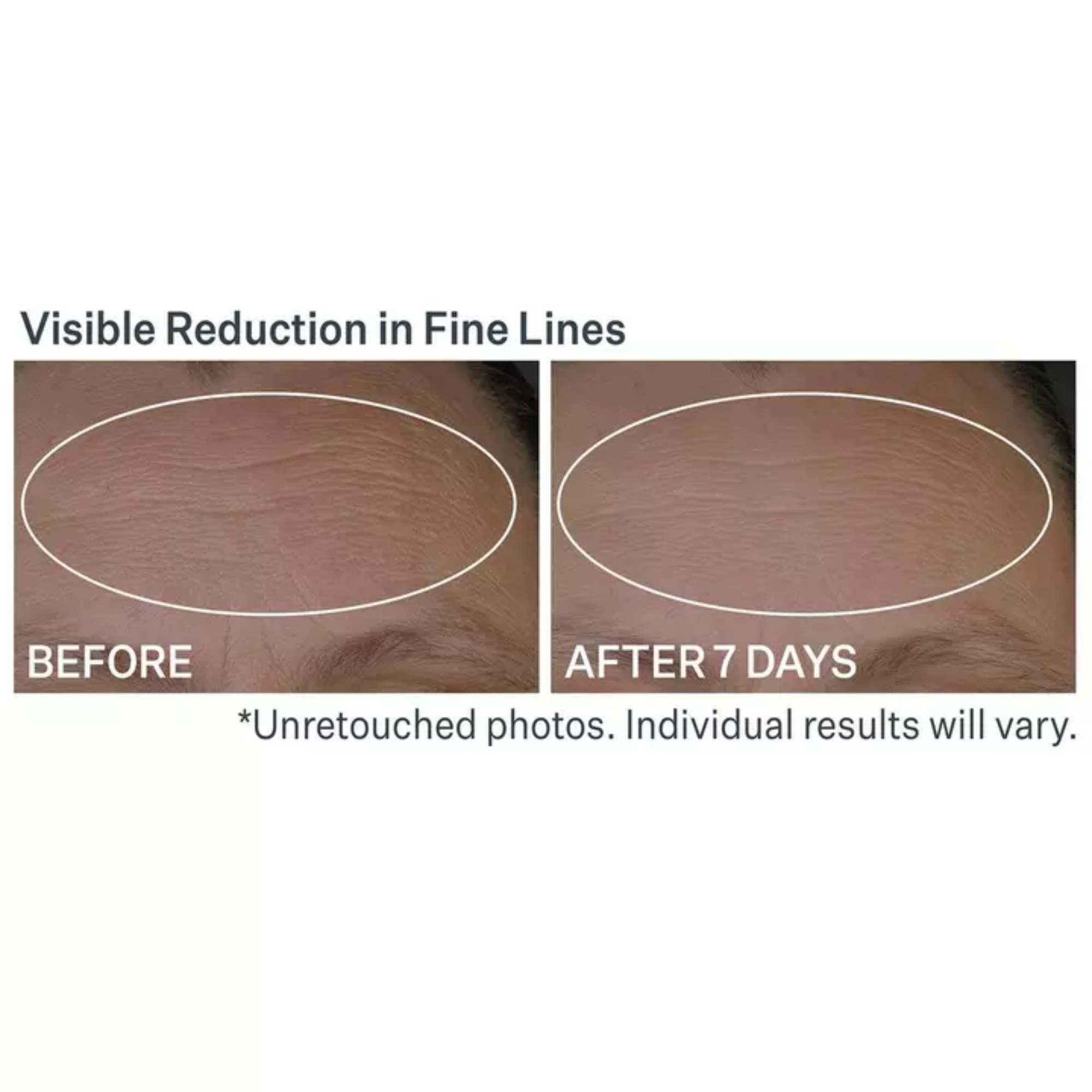 Anti-Wrinkle Peptide Plump Line Filling Bounce Serum