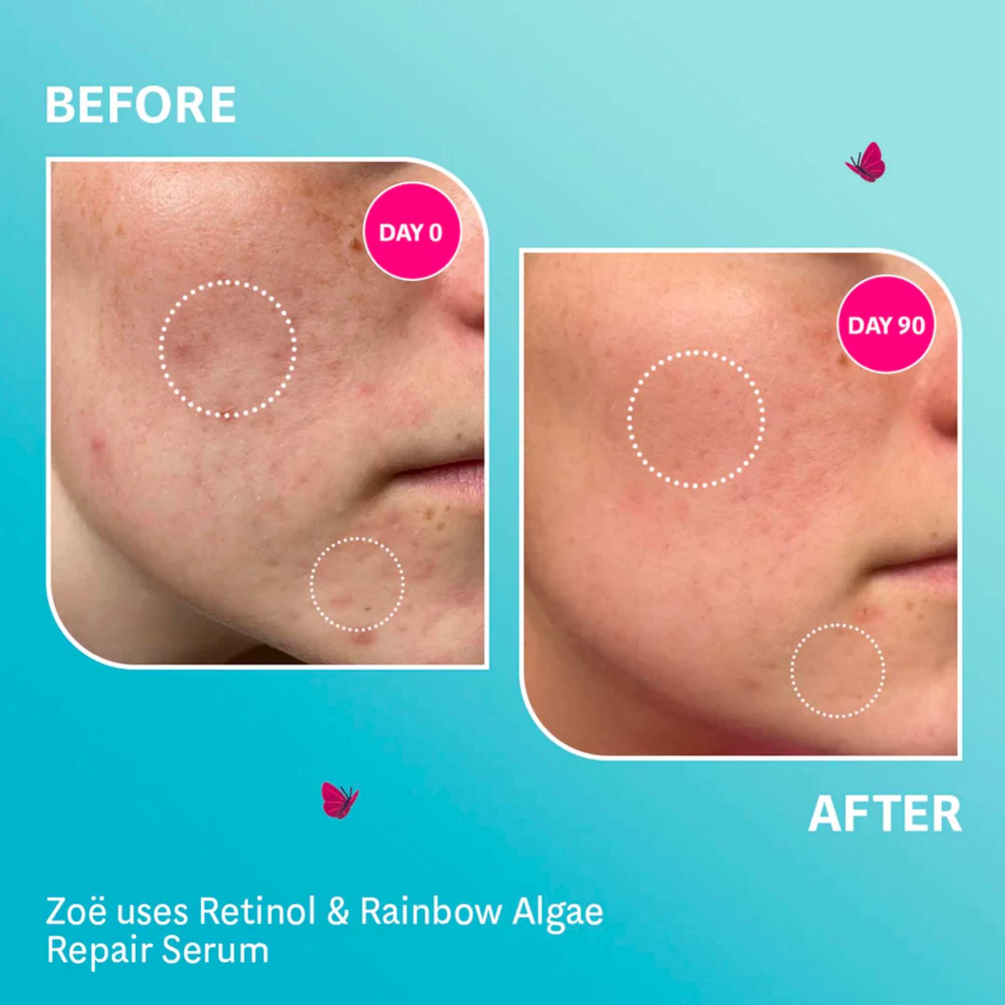 Retinol & Rainbow Algae Repair Serum