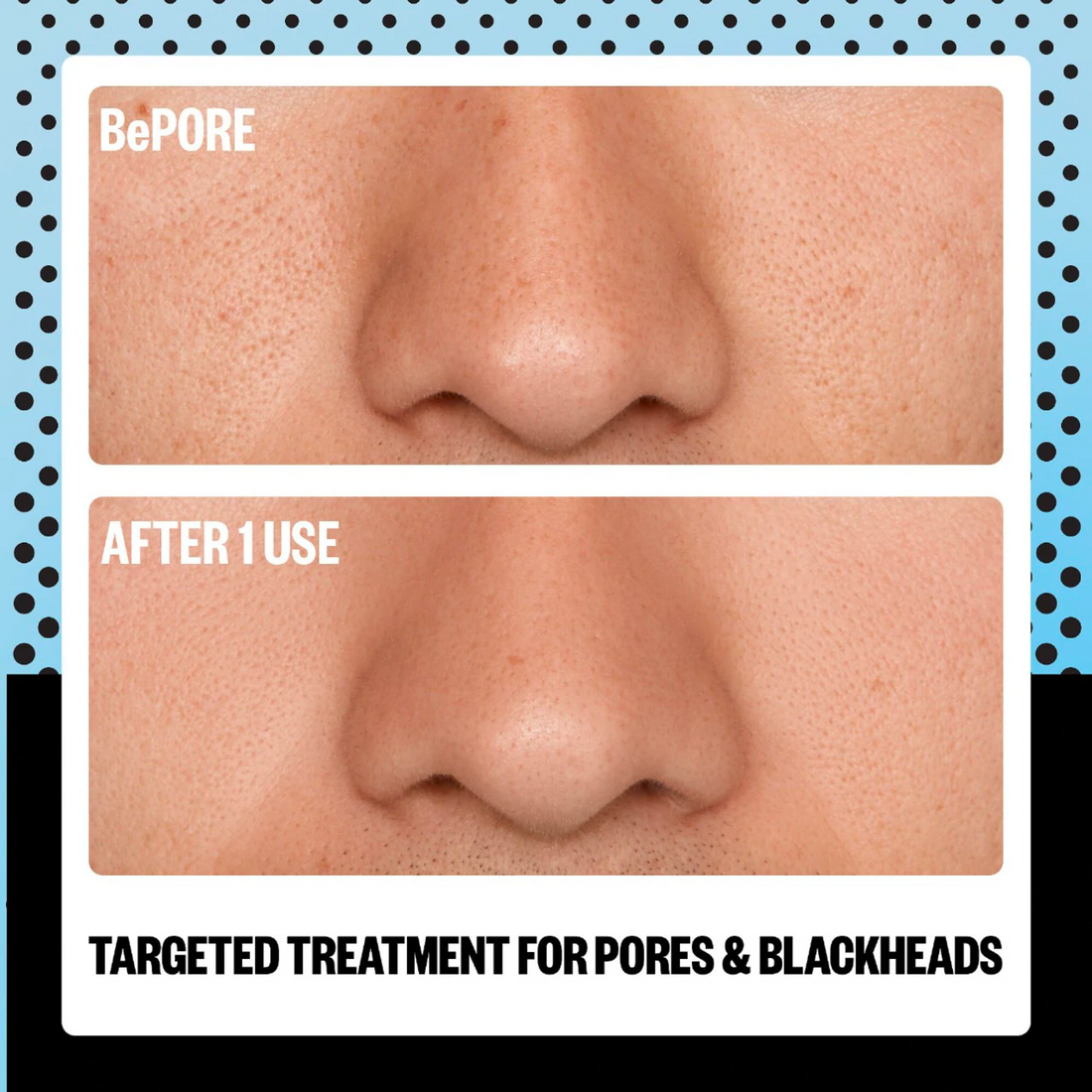 AHA Pore & Blackhead Exfoliator Multitasking Treatment Stick