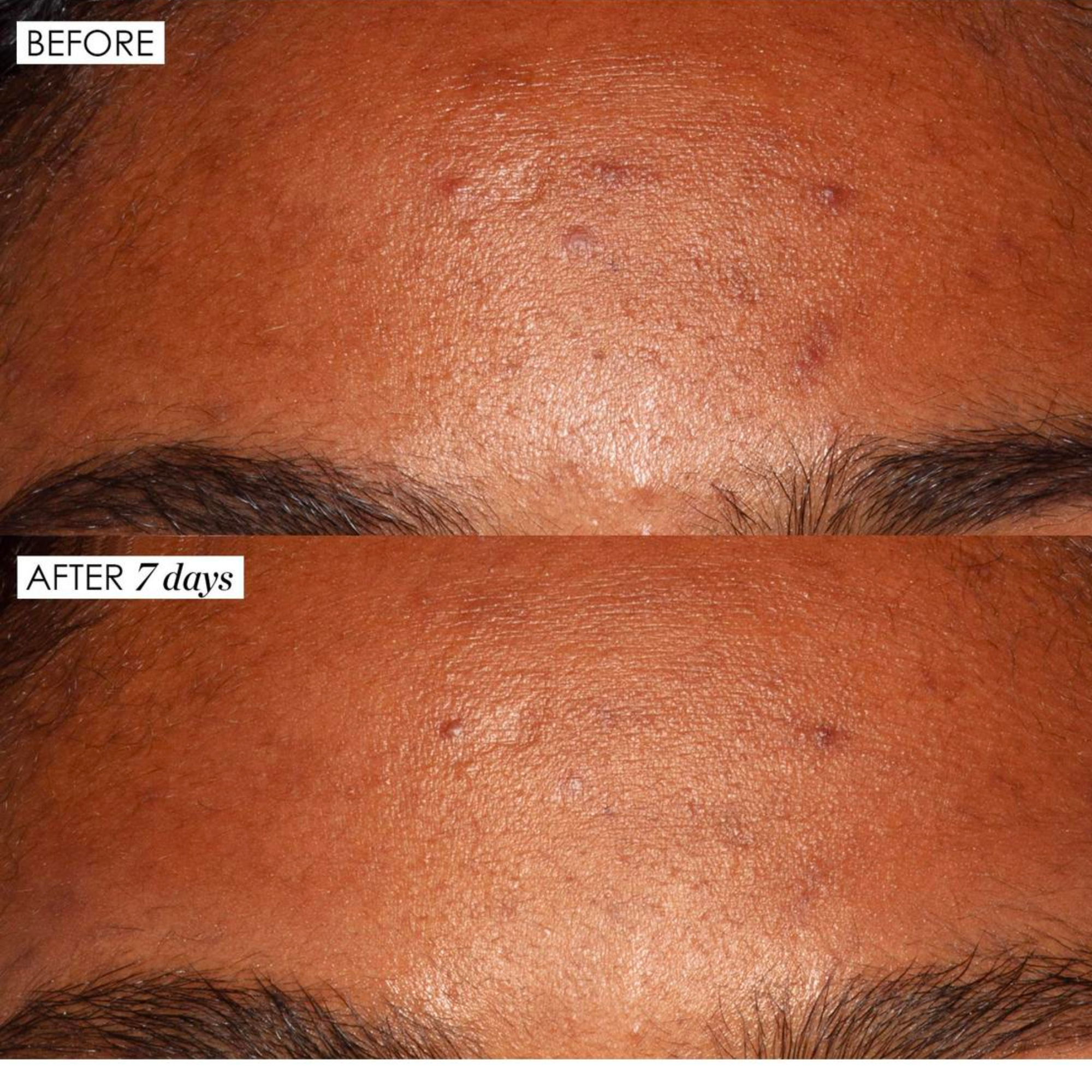 Good Genes All-In-One Lactic Acid Treatment Serum