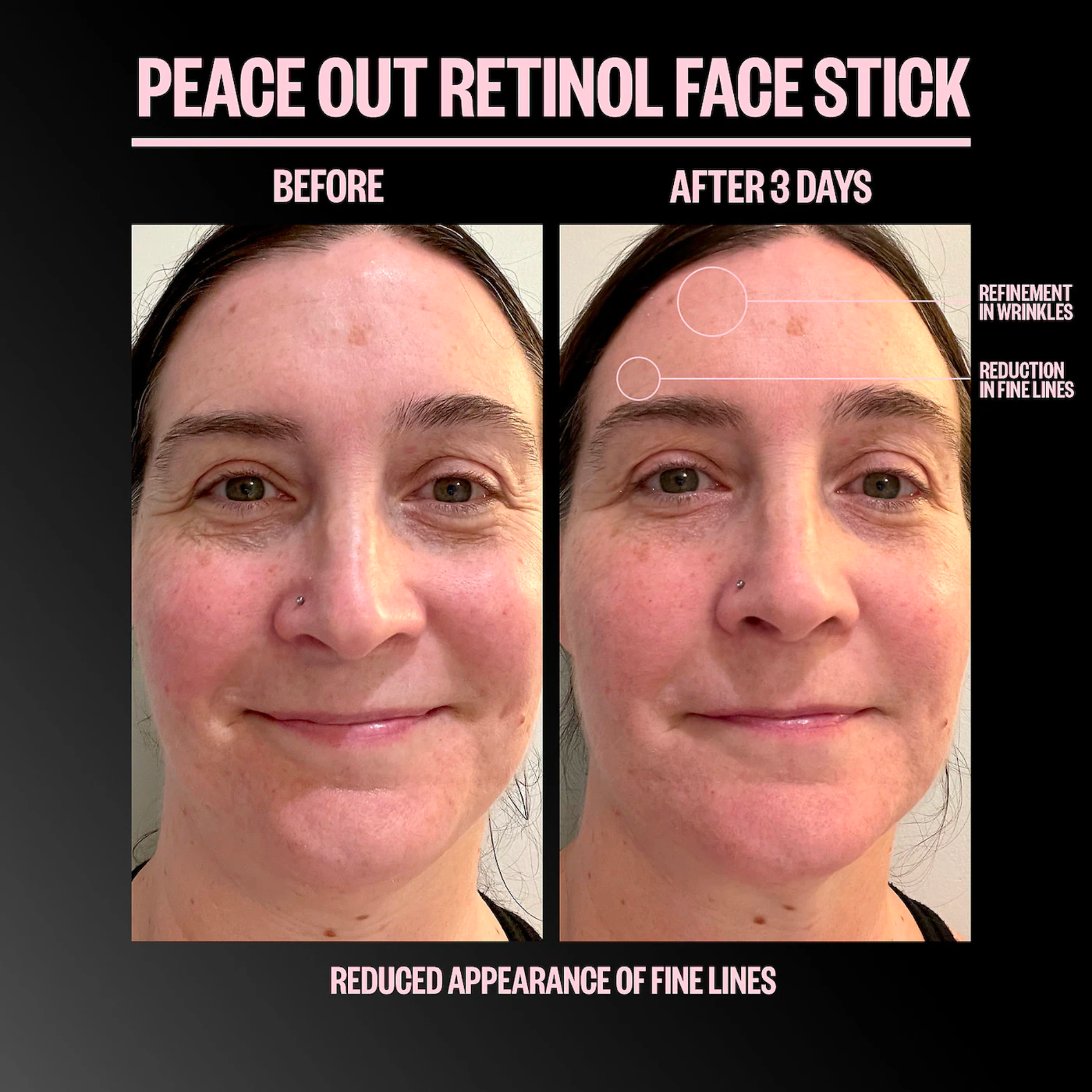 Retinol Face Stick