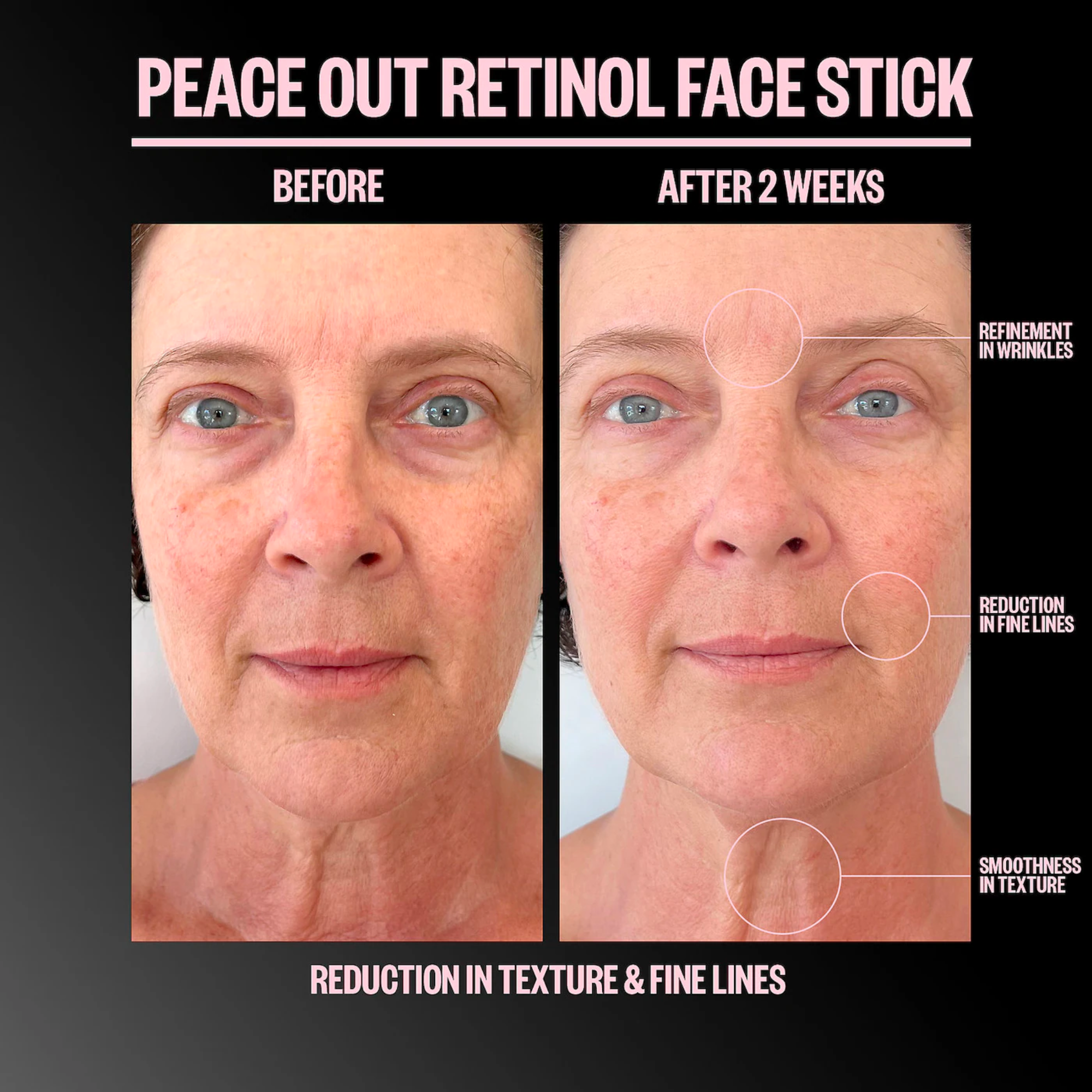 Retinol Face Stick