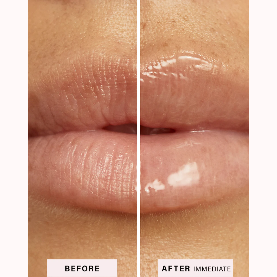 Ultra-hydrating Lip Mask Beso Balm