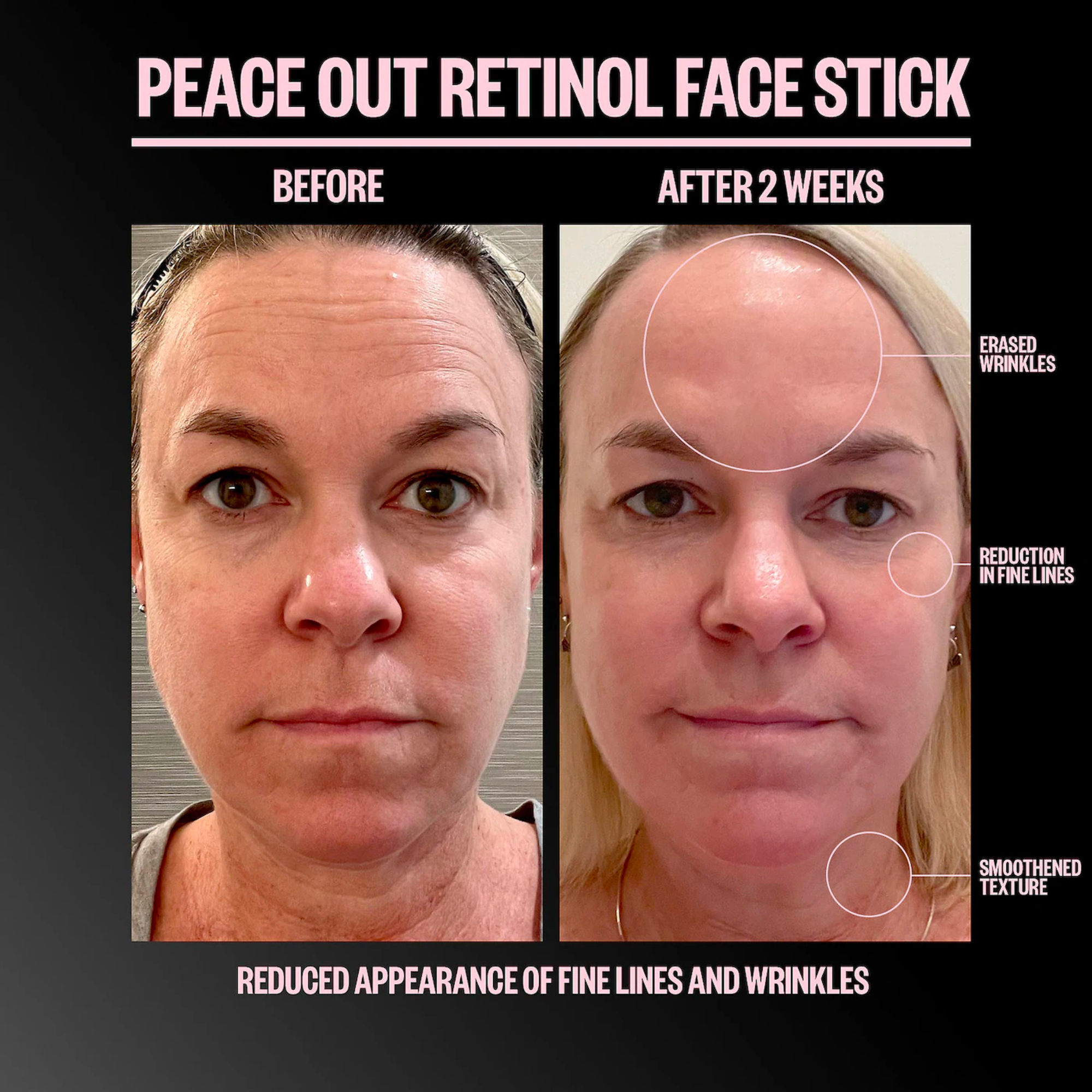 Retinol Face Stick
