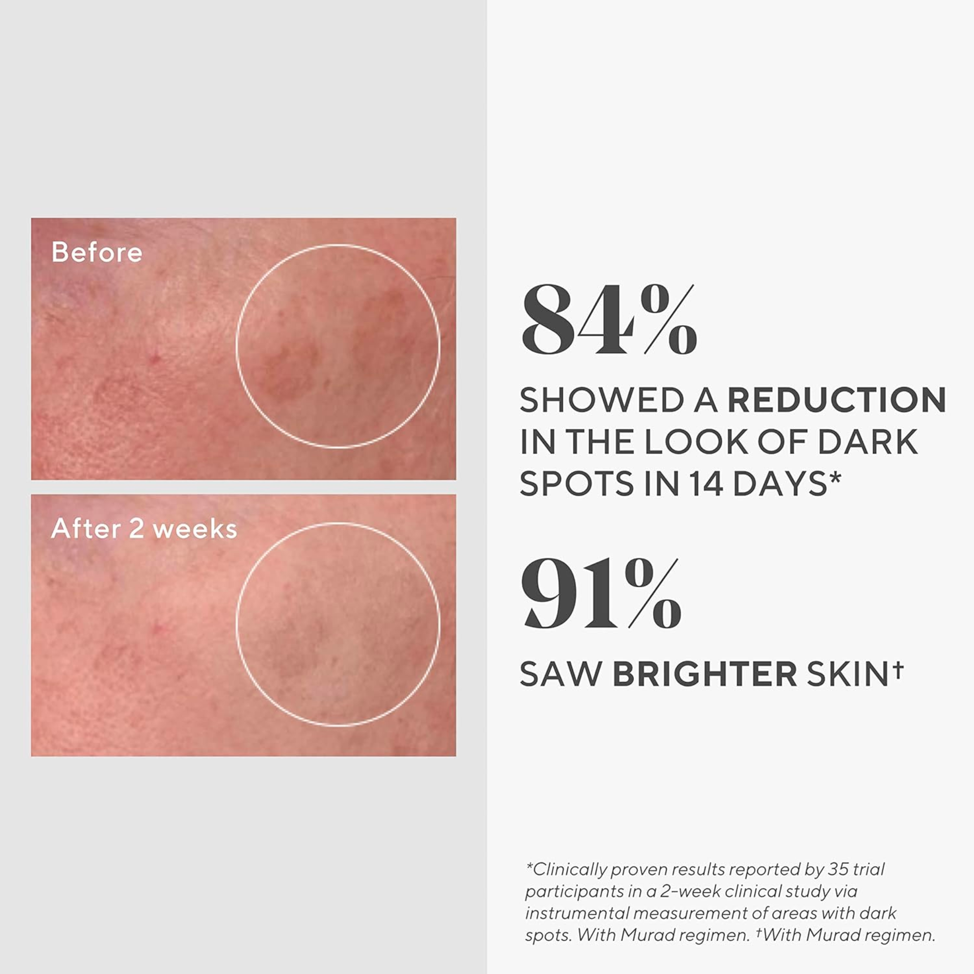 Rapid Dark Spot Correcting Serum