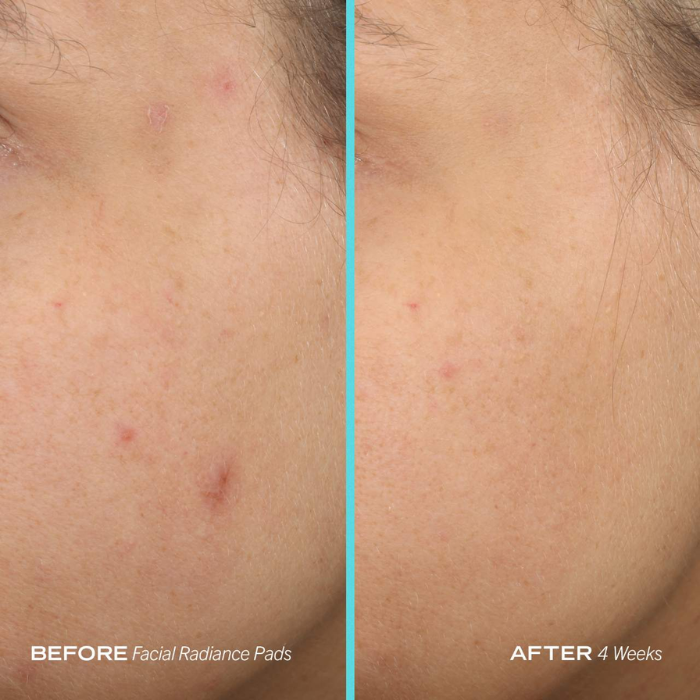 Facial Radiance Pads With Glycolic + Lactic Acids First Aid Beauty