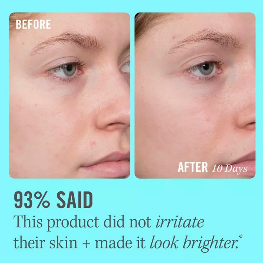 10% Vitamin C Brightening Serum