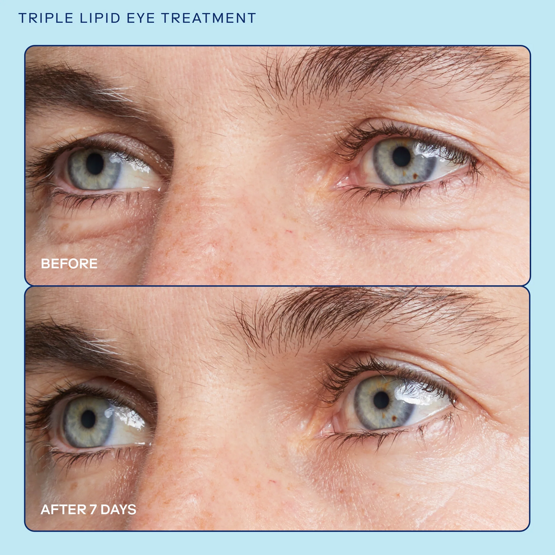 Barrier+Triple Lipid Eye Treatment