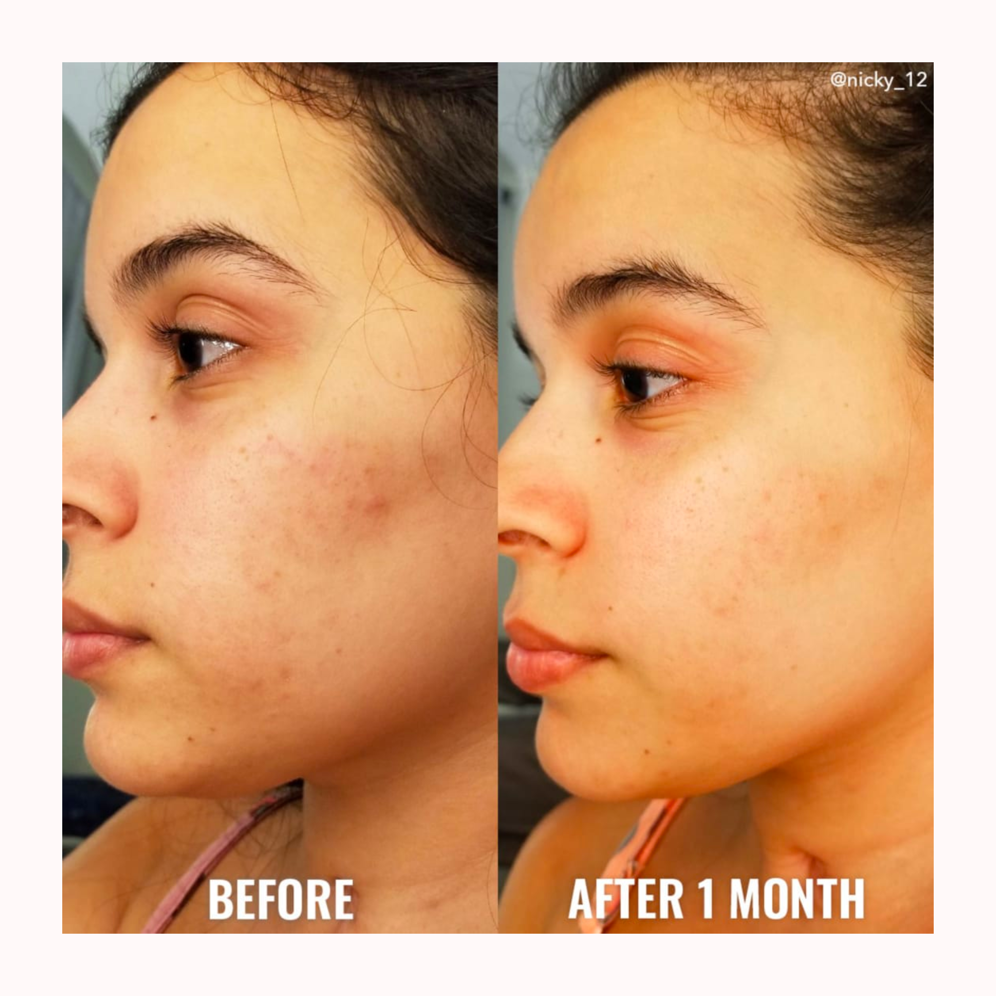 GLYCOLIC EXFOLIATING TONER