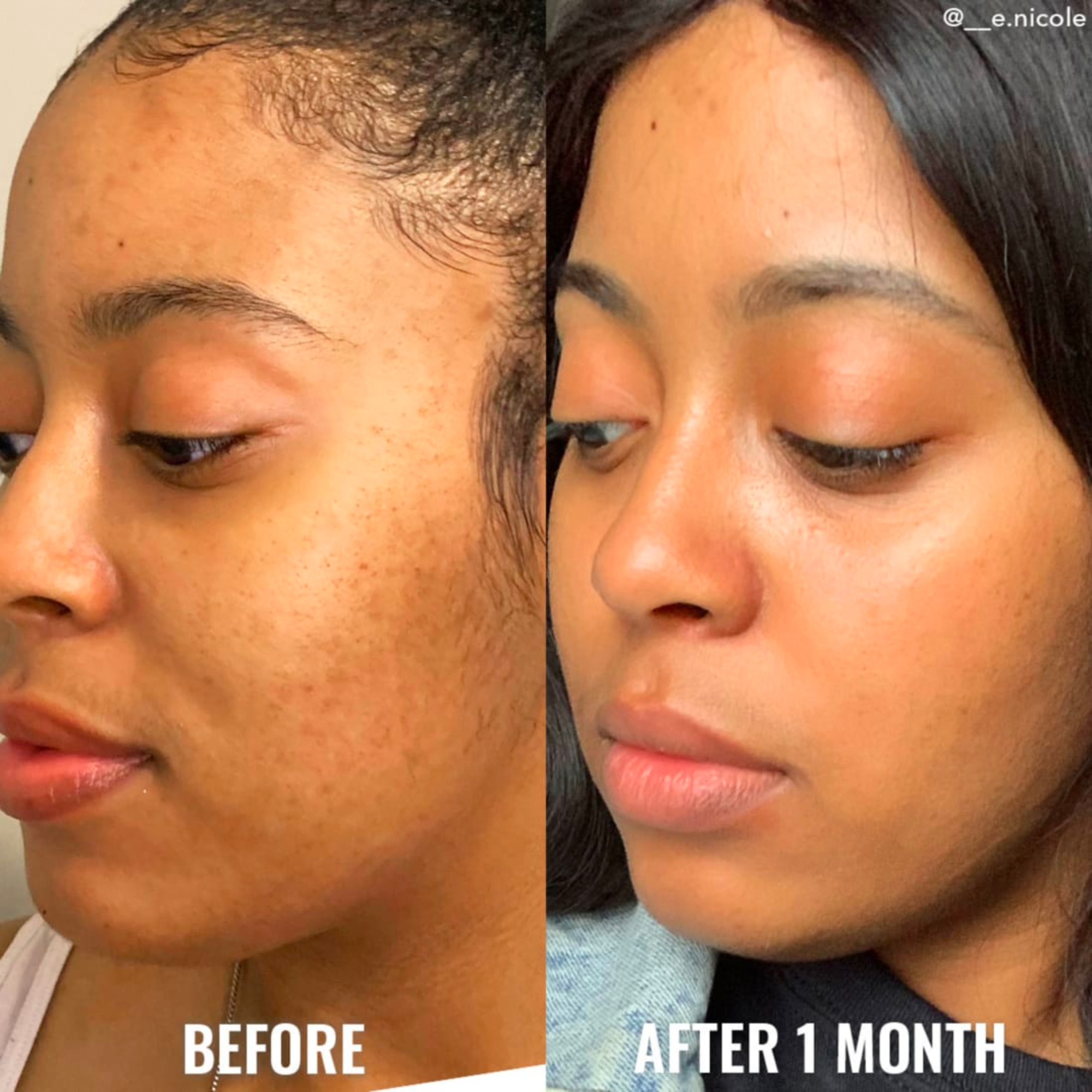 The Glow Skin Set: Glycolic Exfolianting Toner + Hyaluronic Acid Serum