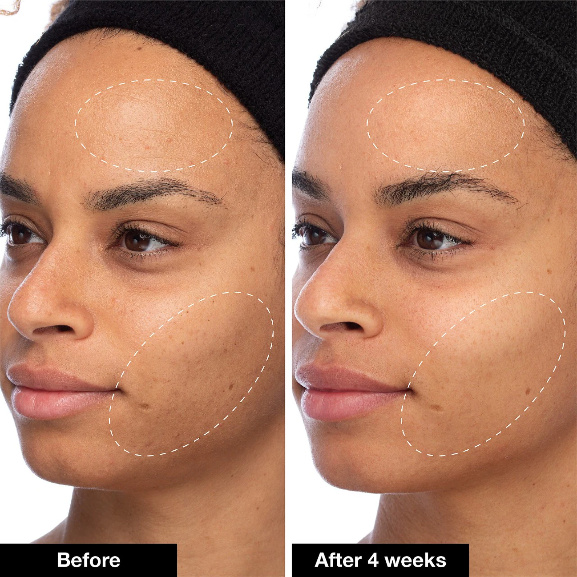 Slushy Serum Moisturizer Crush Infused With Bakuchiol