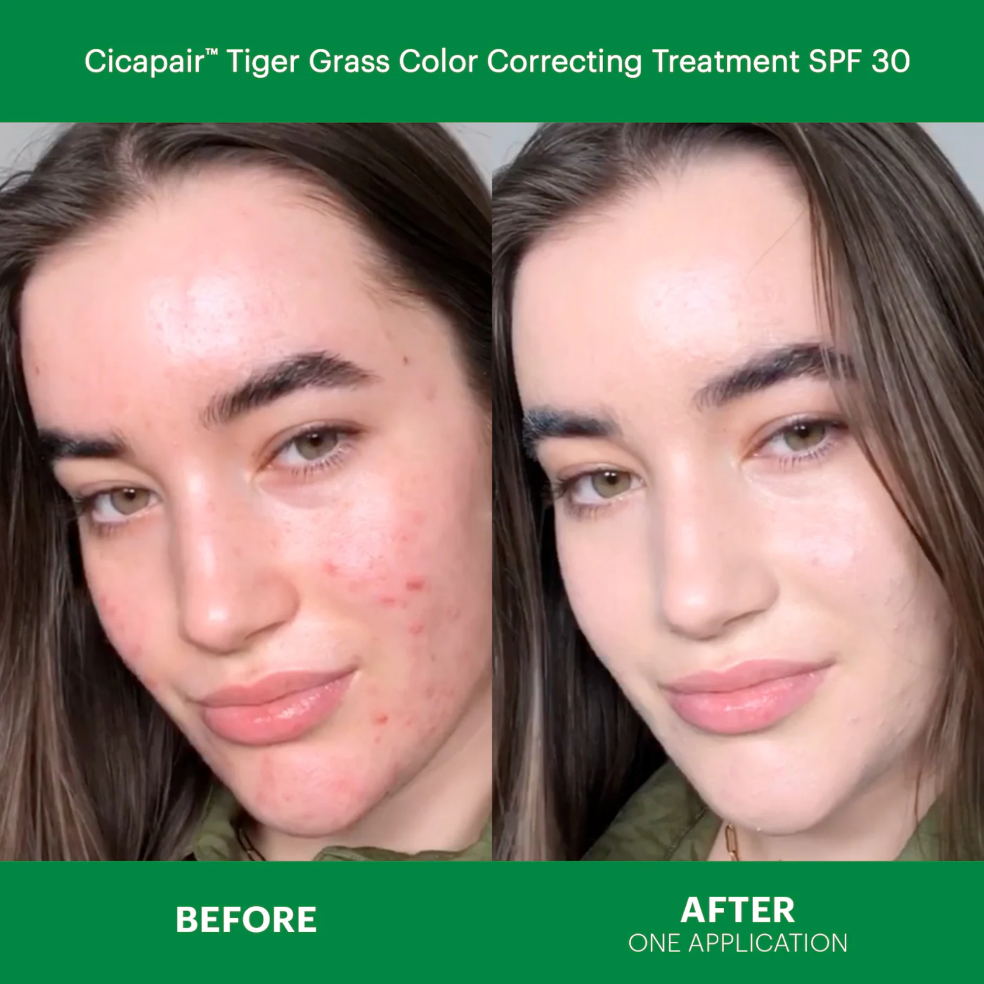 Cicapair™ Redness Rescue Kit for Sensitive Skin