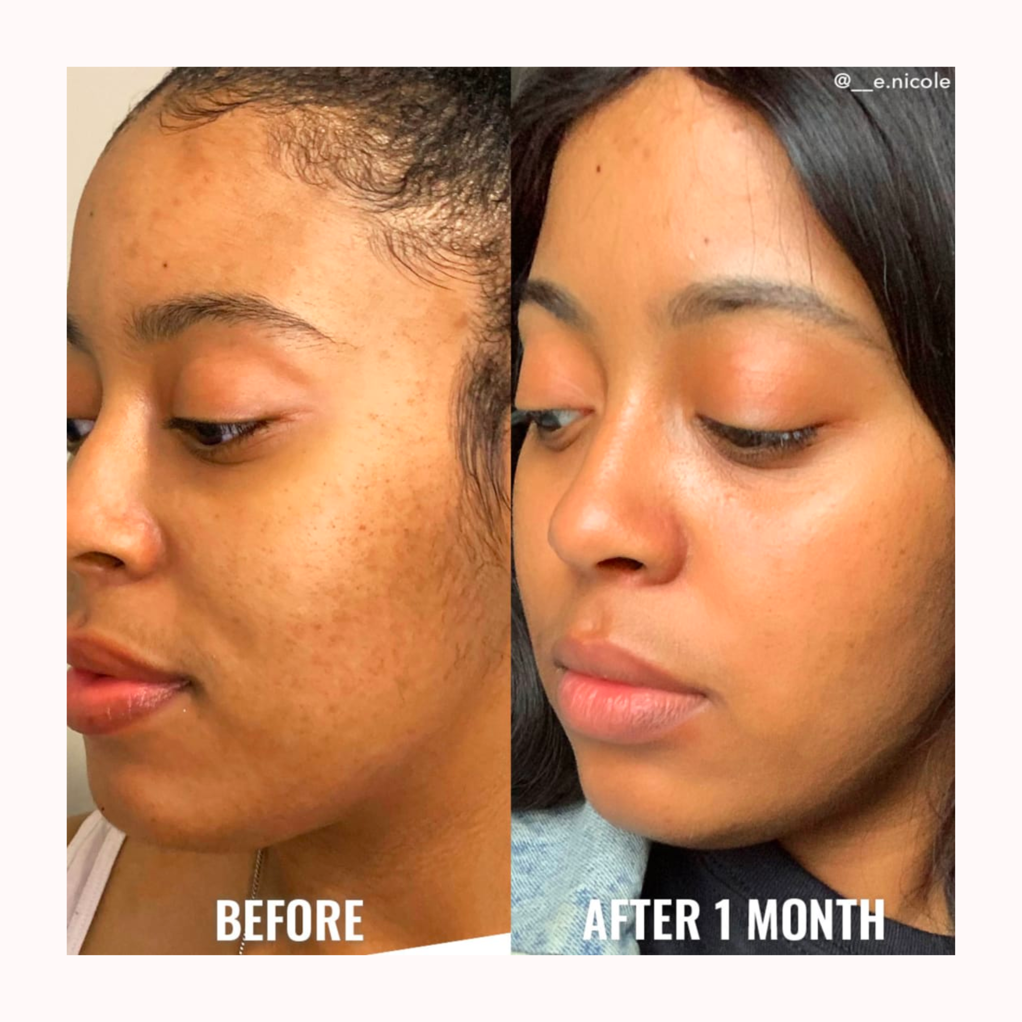 GLYCOLIC EXFOLIATING TONER