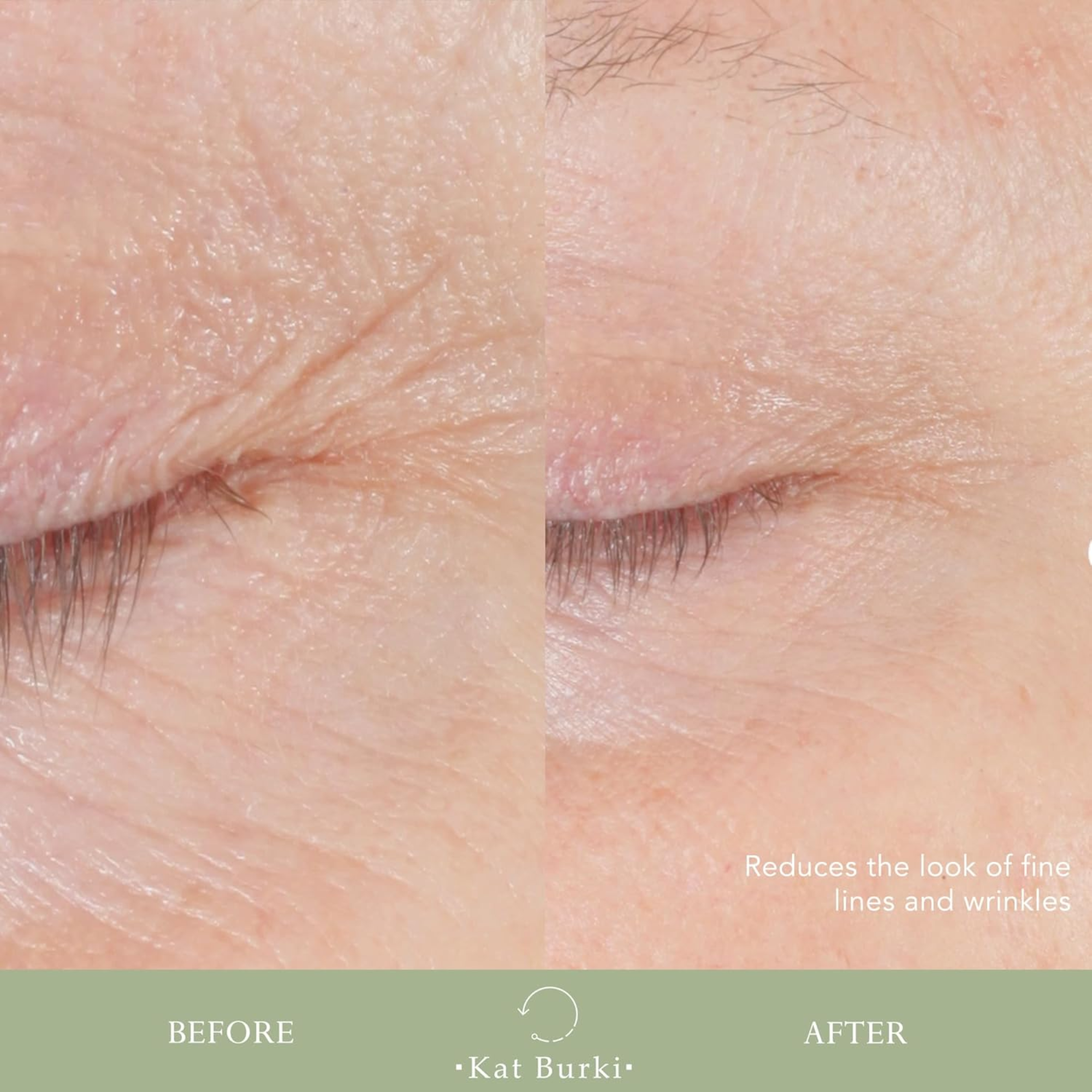 Lift Fill Form Control Marine Collagen Gel