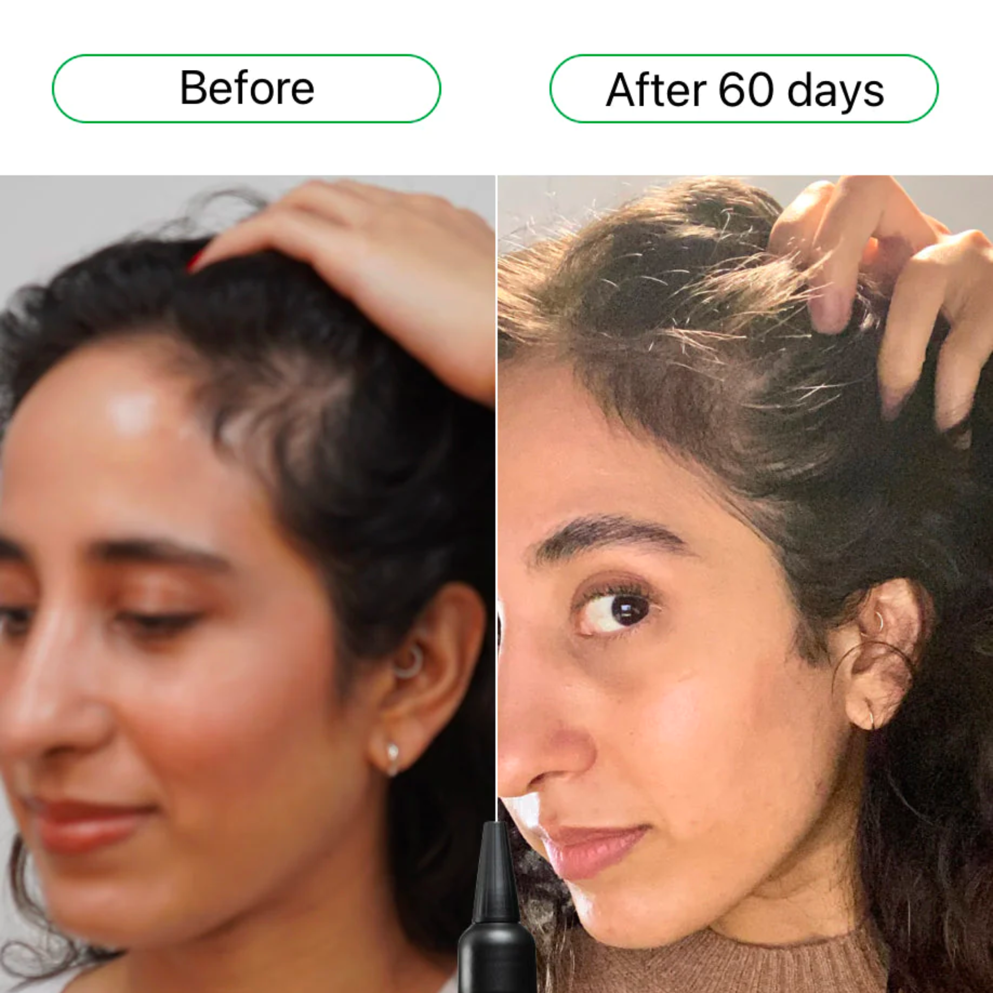 Supa thick Scalp Serum Hair Treatment