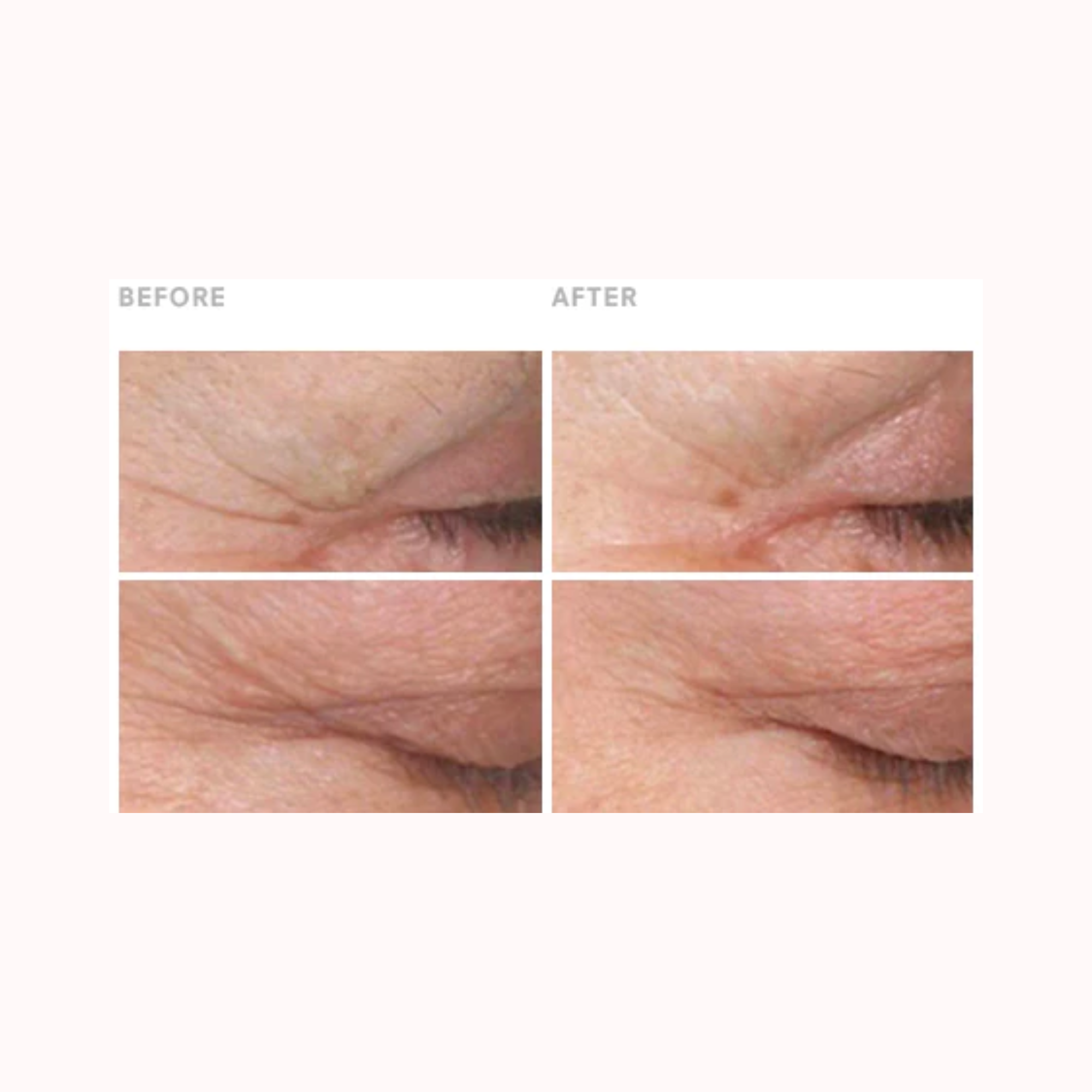 Stem Cellular Anti-wrinkle Retinol Overnight Serum