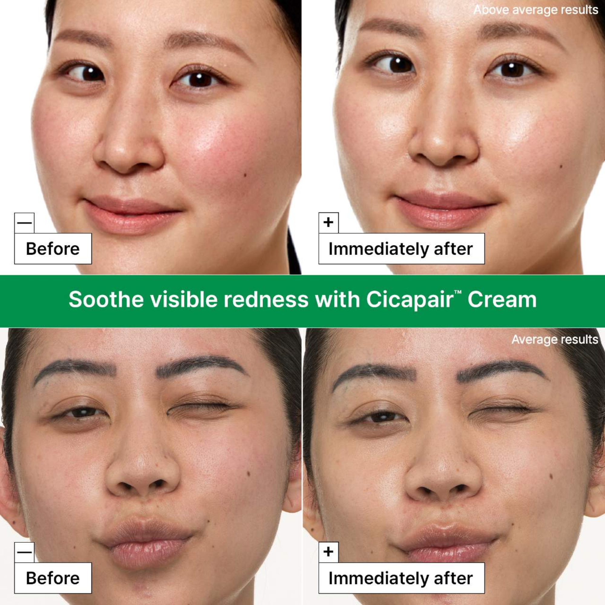 Cicapair™ Redness Rescue Kit for Sensitive Skin