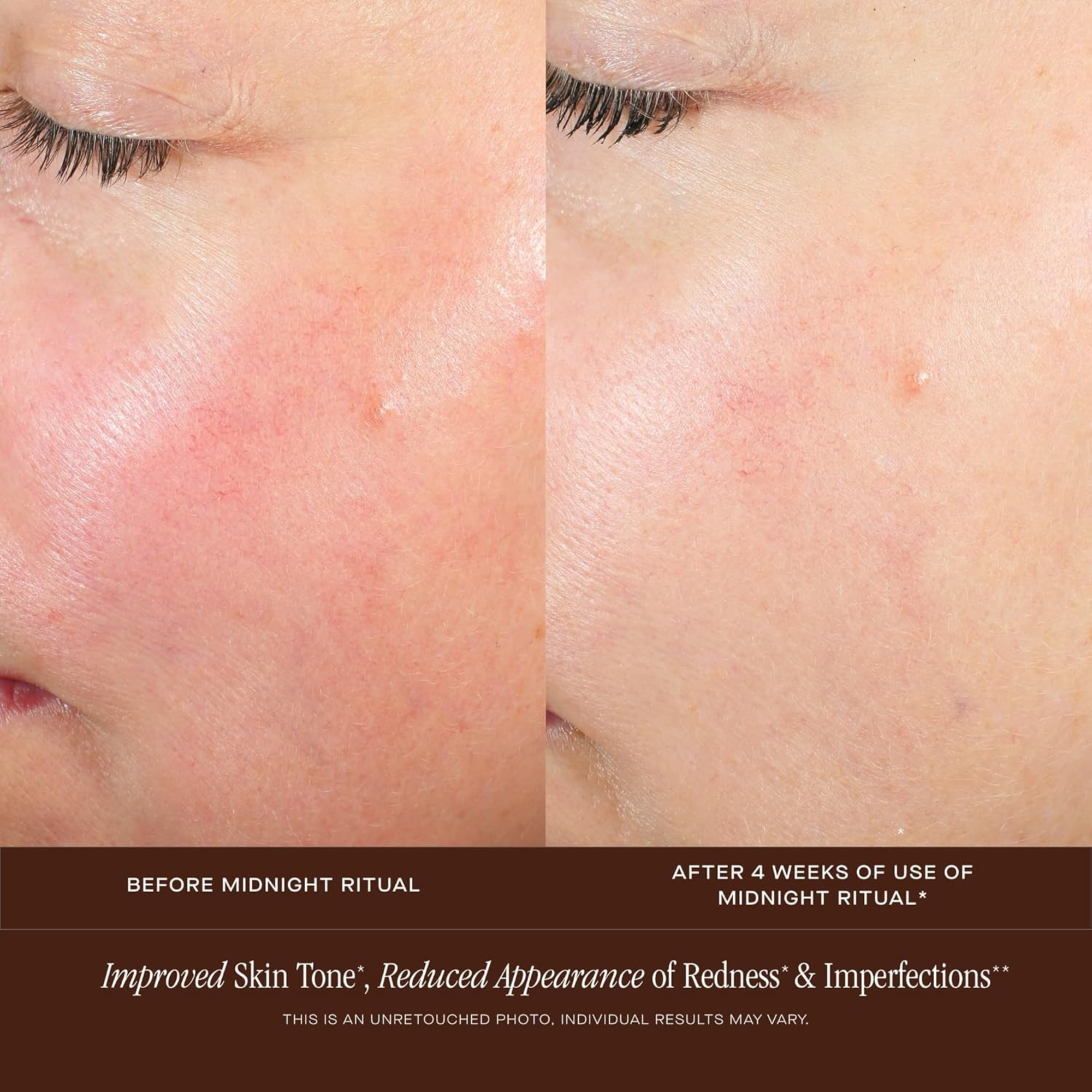 Midnight Ritual Retinol® Renewal Serum