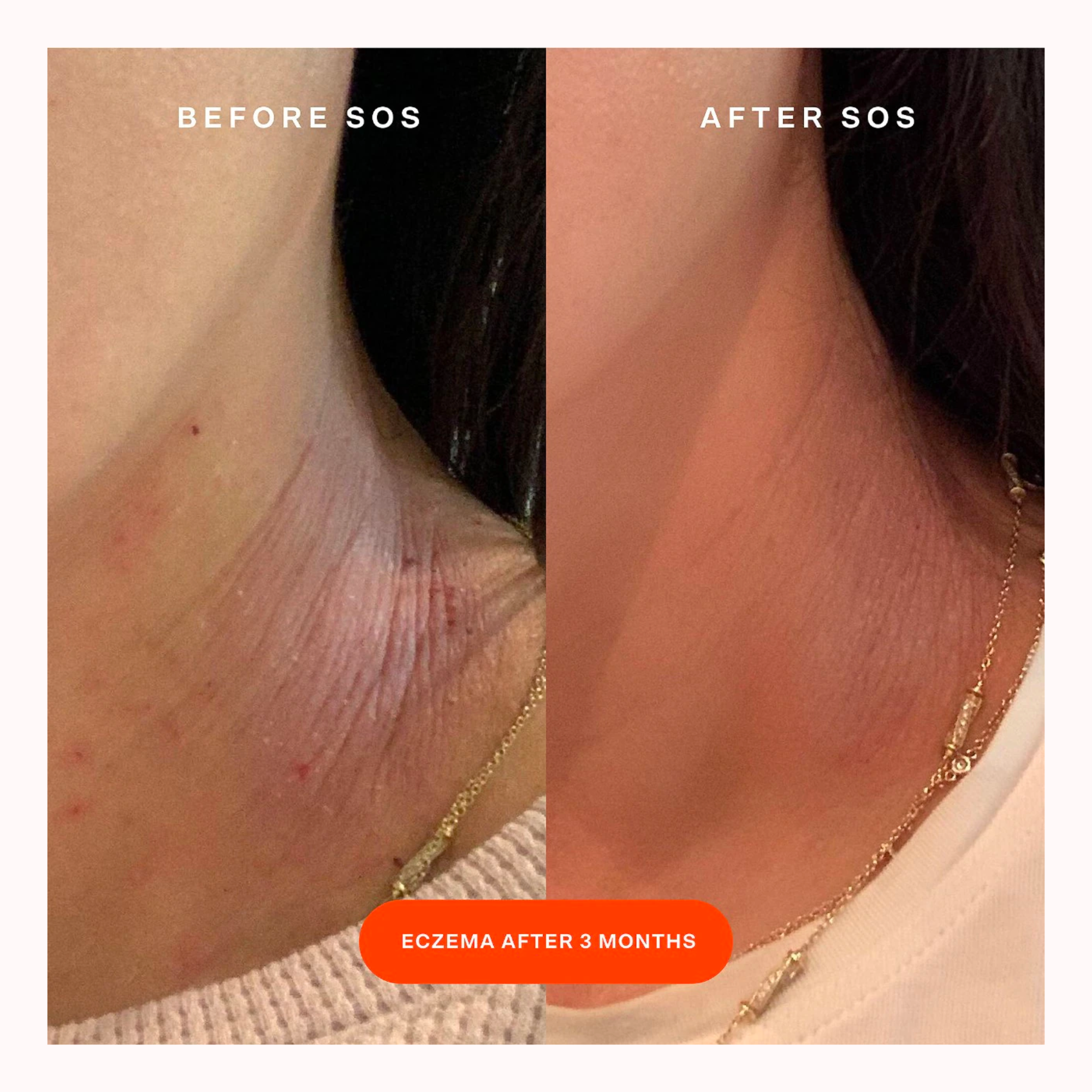 SOS Daily Rescue Facial Spray