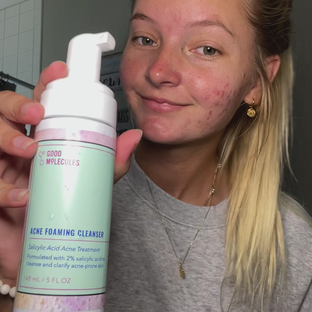 Acne Foaming Cleanser