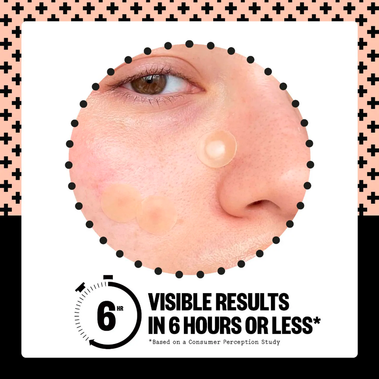 Salicylic Acid Acne Healing Dots