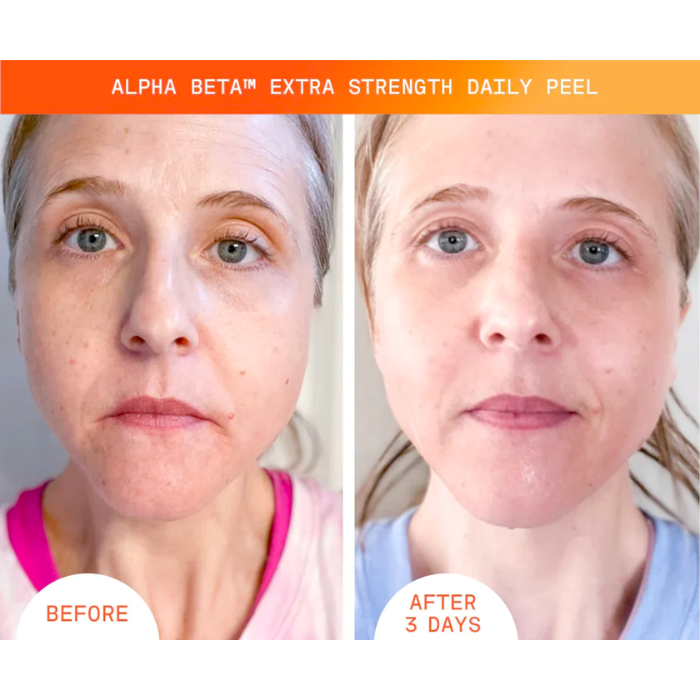 Alpha Beta® Extra Strength Daily Peel Pack