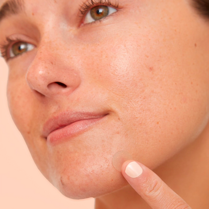 Salicylic Acid Acne Healing Dots