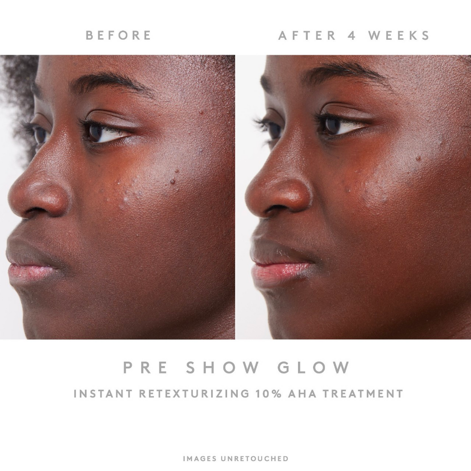 10% AHA Treatment Pre-Show Glow Refillable Instant Retexturizing