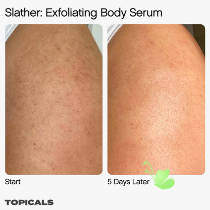 Slather Exfoliating Body Serum with Retinol and AHAs