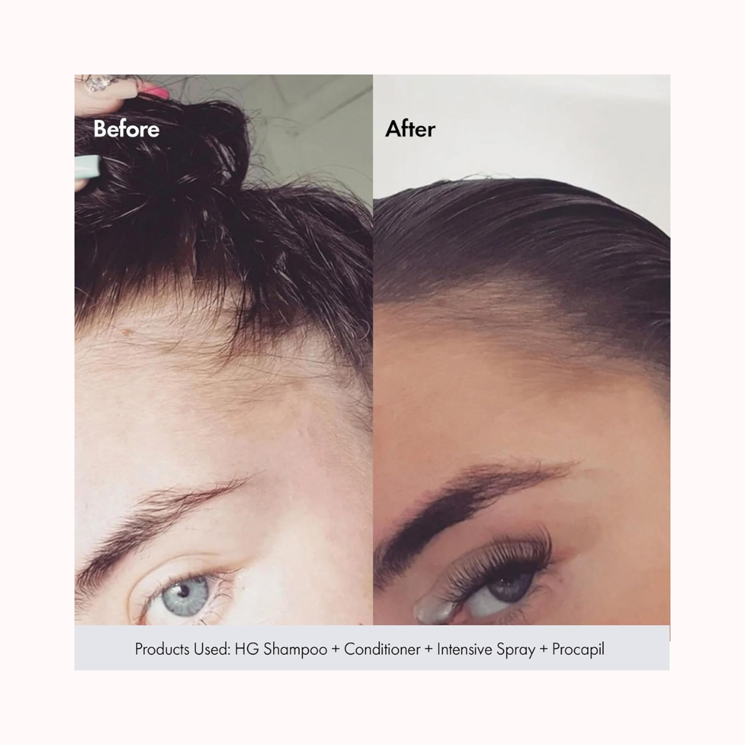 Intensive Daily Scalp Spray For Thinning Hair with Rosemary