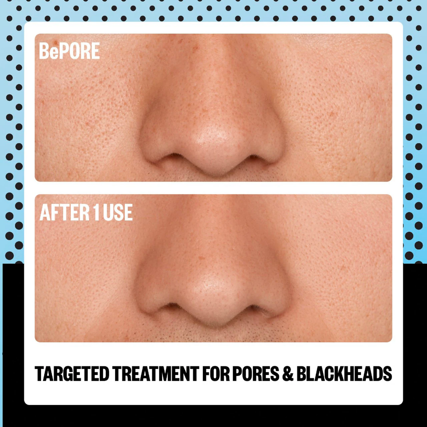 AHA Pore &amp; Blackhead Exfoliator Multitasking Treatment Stick