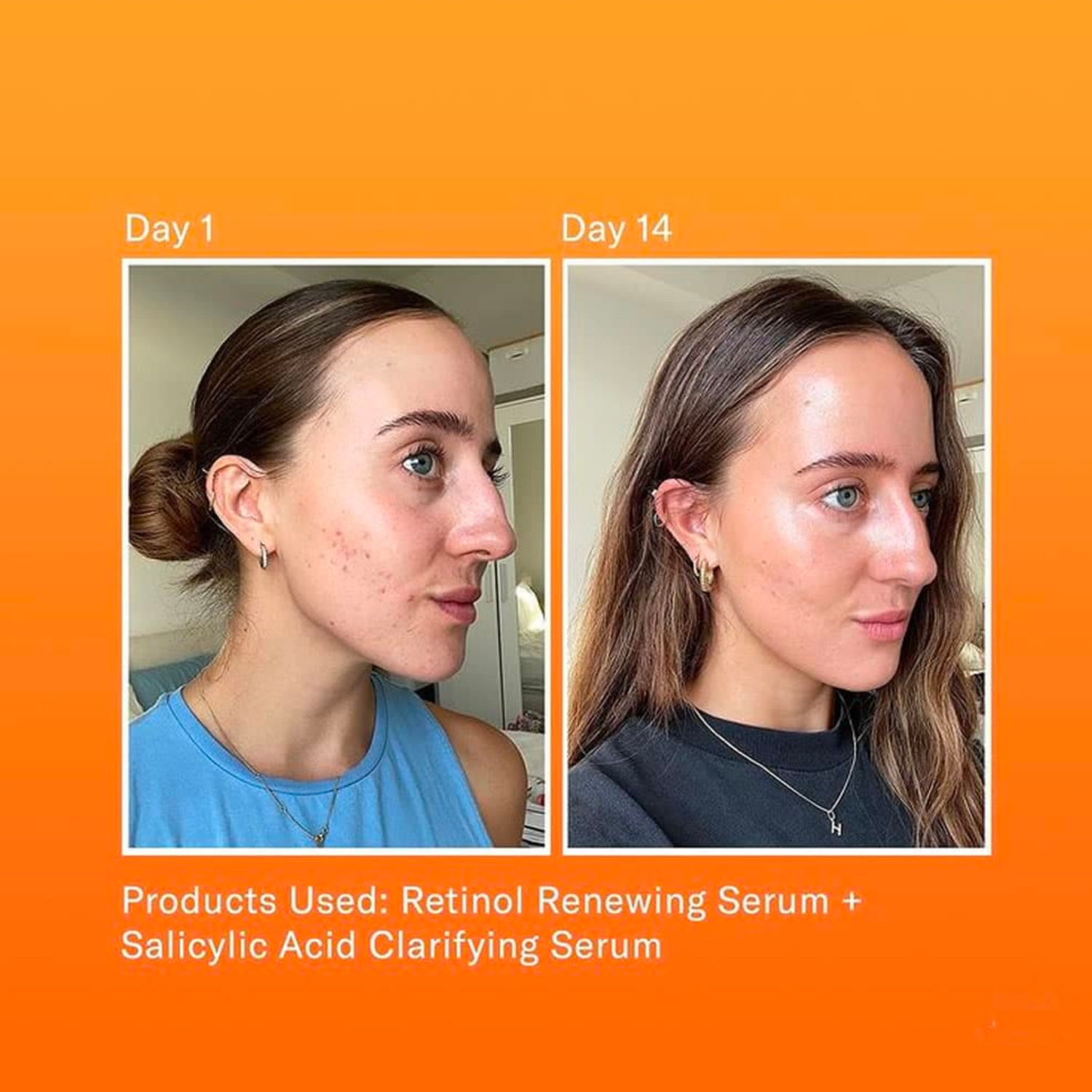 Renewing Serum • Retinol + Hyaluronic Acid