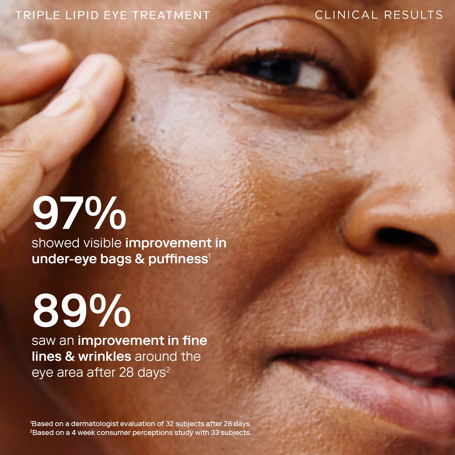 Barrier+Triple Lipid Eye Treatment