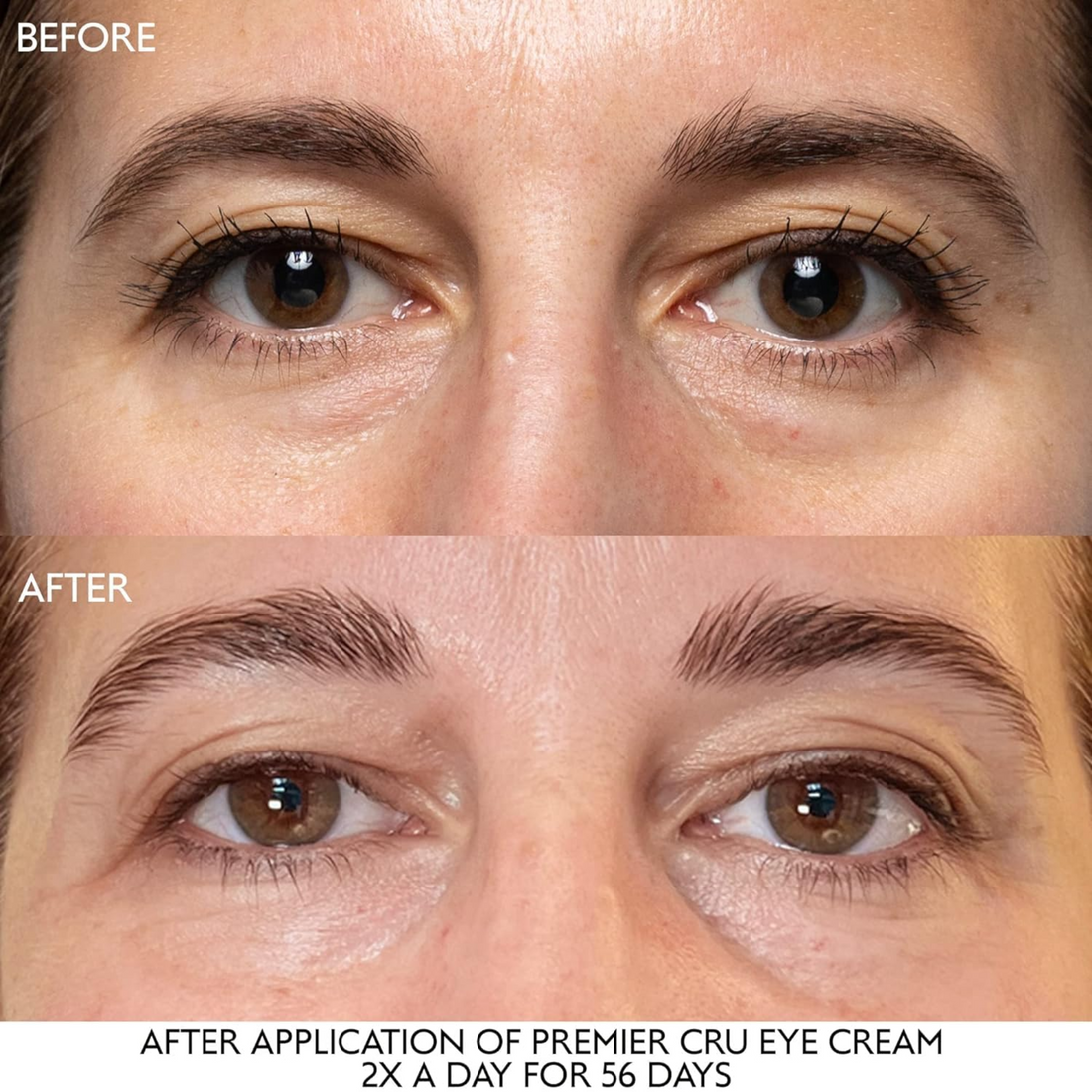 Premier Cru Anti-aging Eye Cream For Fine Lines And Wrinkles