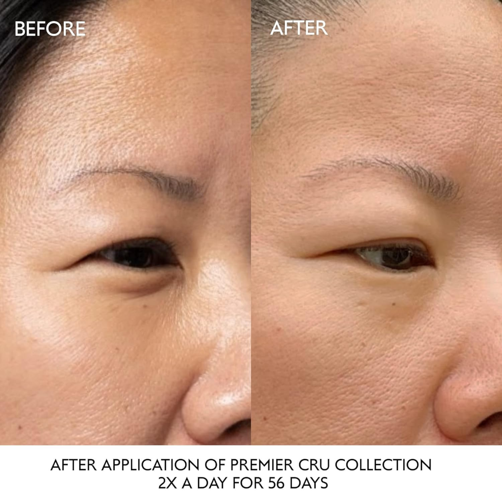 Premier Cru Anti-aging Eye Cream For Fine Lines And Wrinkles