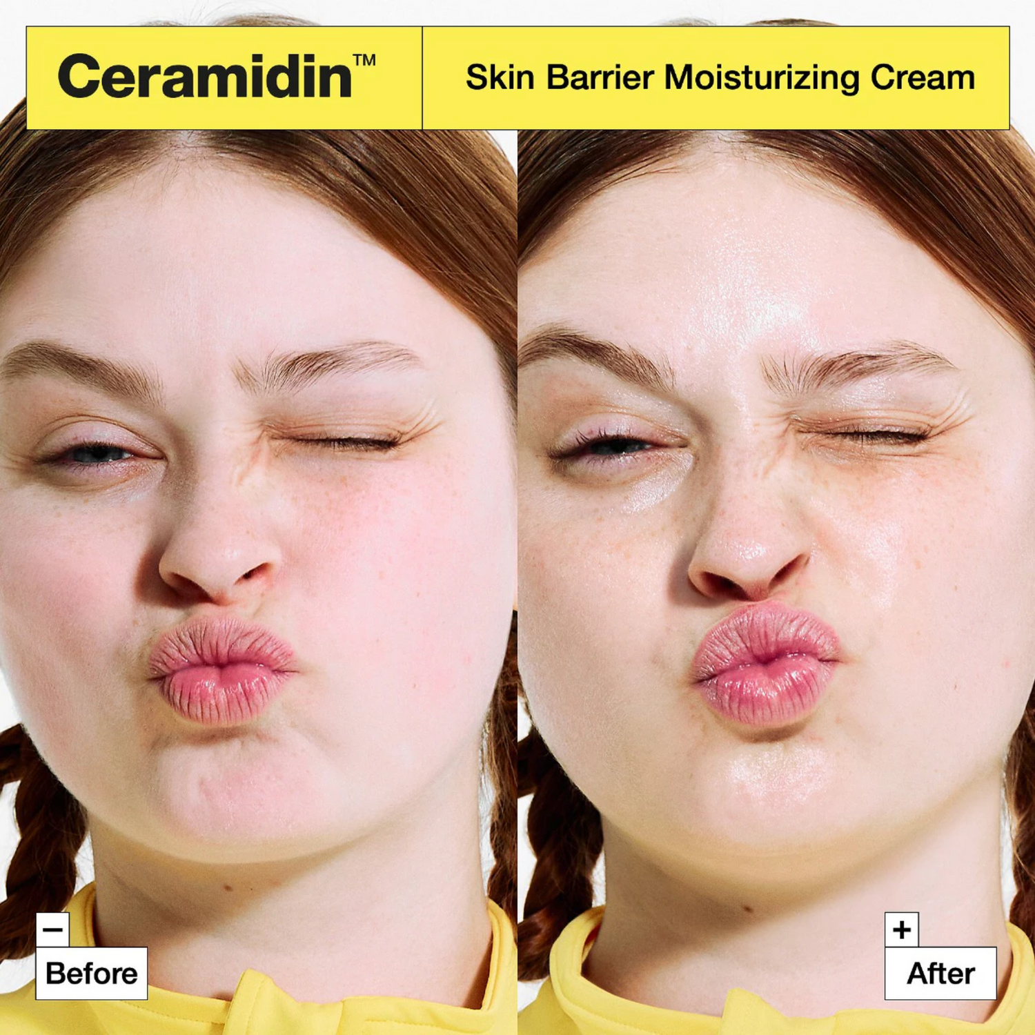 Ceramidin™ Skin Barrier Moisturizing Cream