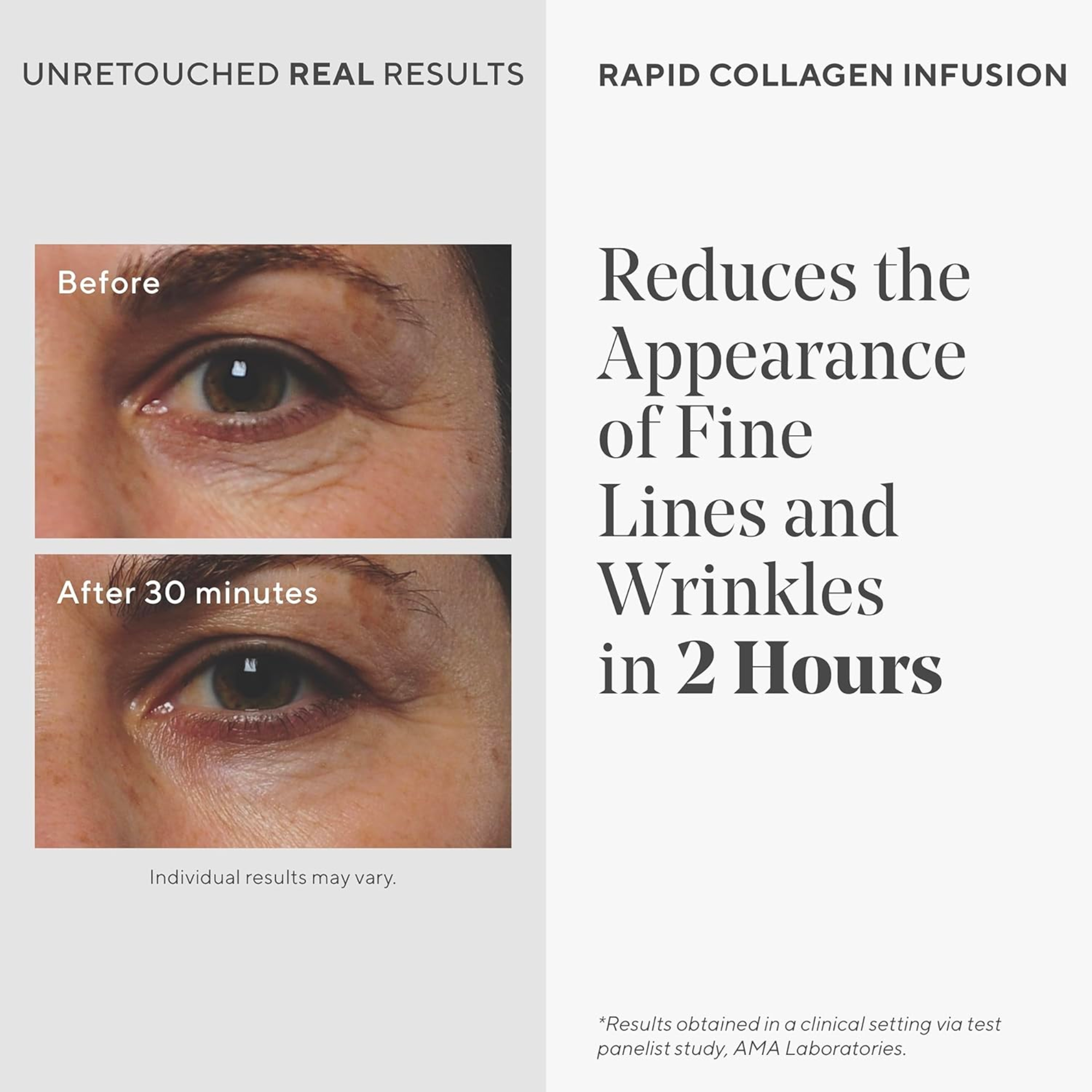 Rapid Collagen Infusion