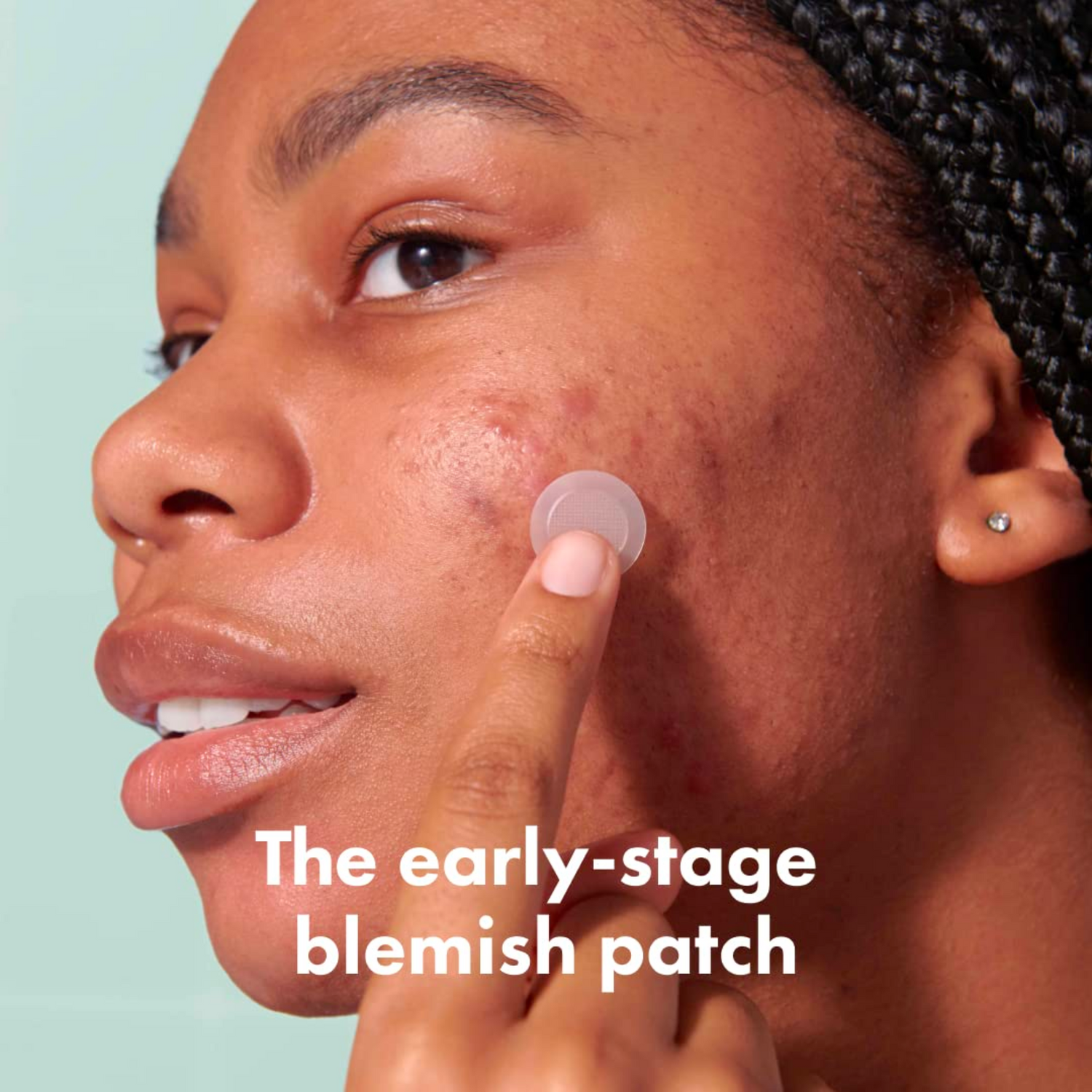 Mighty Patch, Micropoint for Blemishes