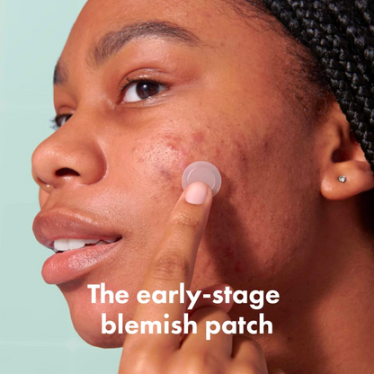 Mighty Patch, Micropoint for Blemishes